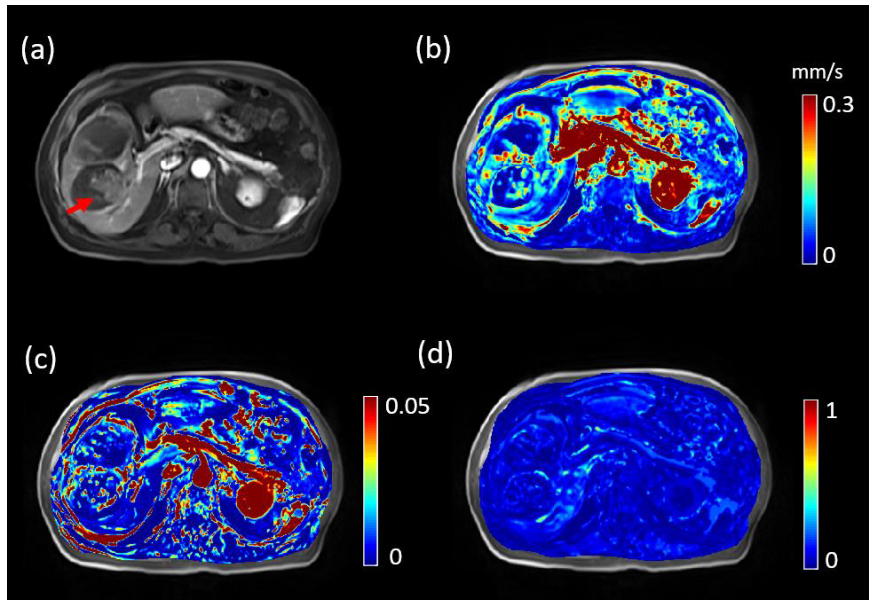 Tomography 08 00224 g002