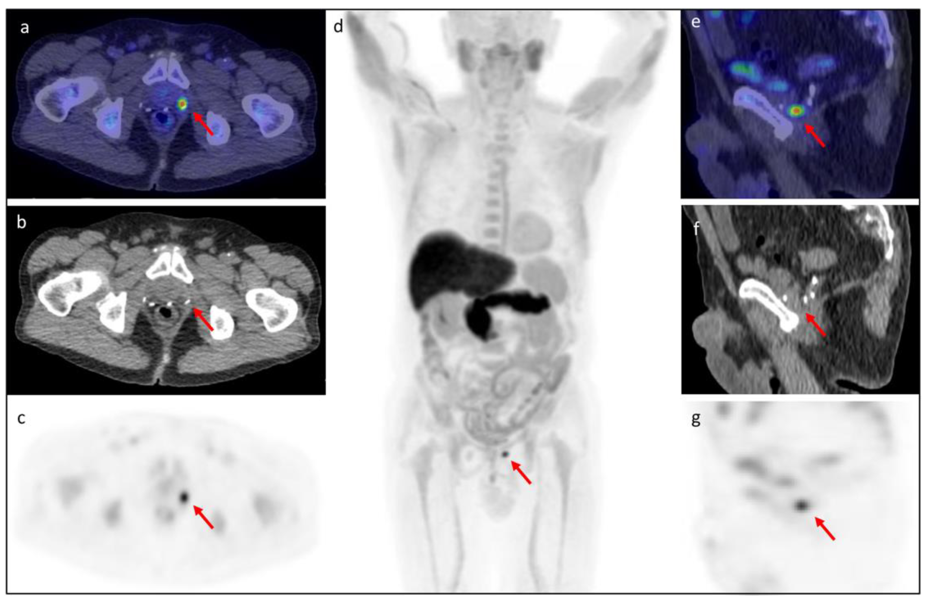Tomography 08 00226 g003
