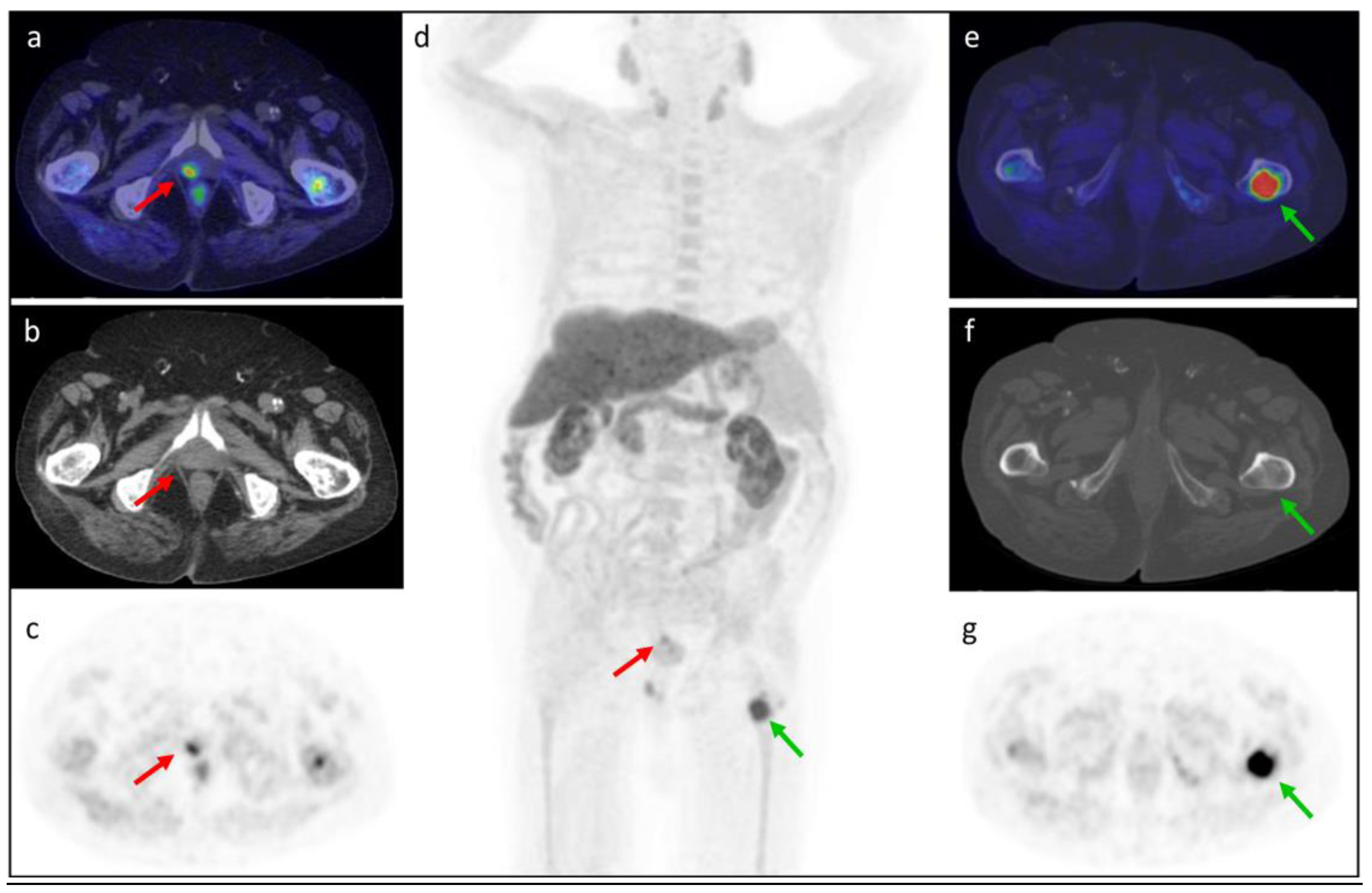 Tomography 08 00226 g004