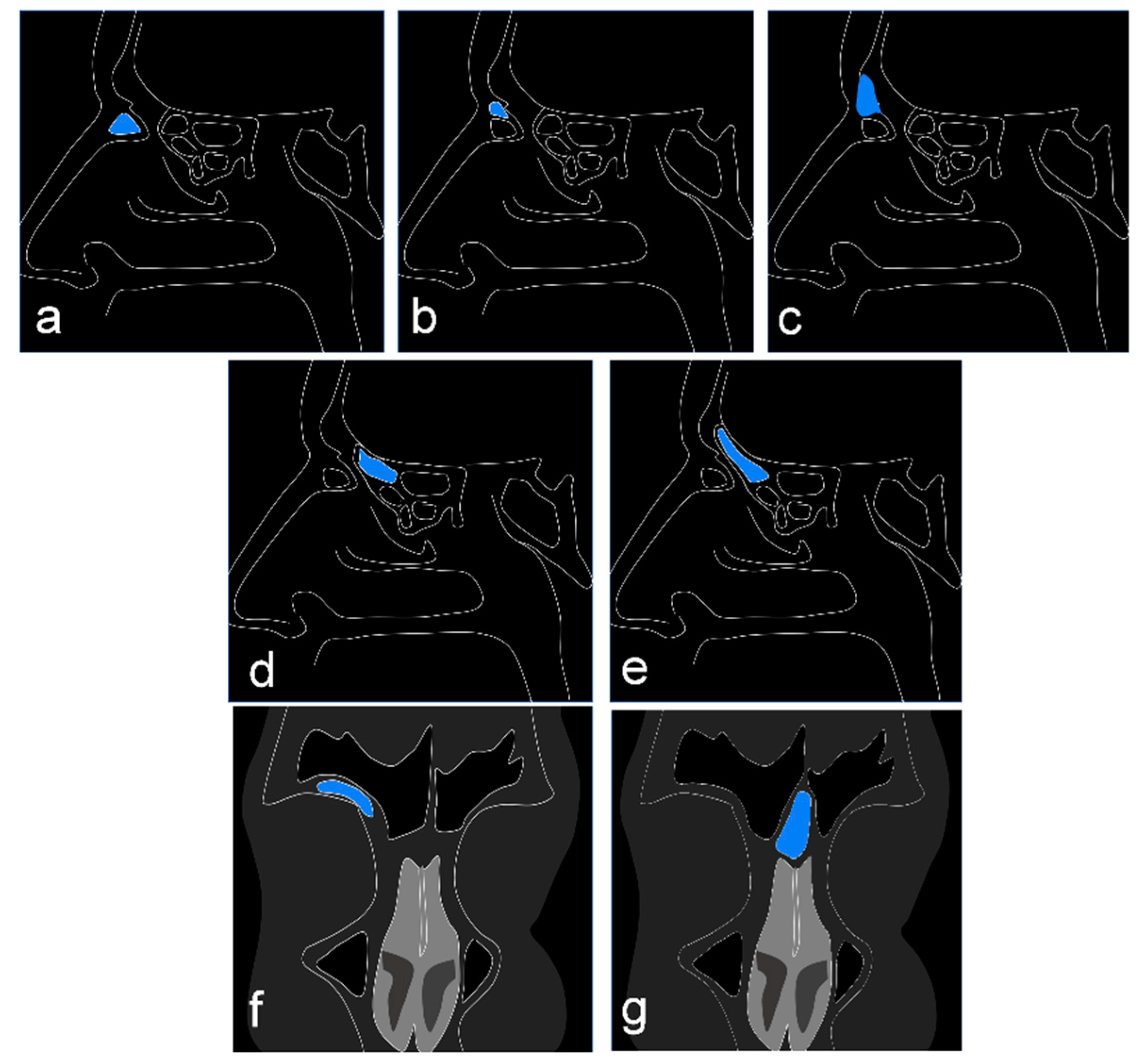 Tomography 08 00233 g001