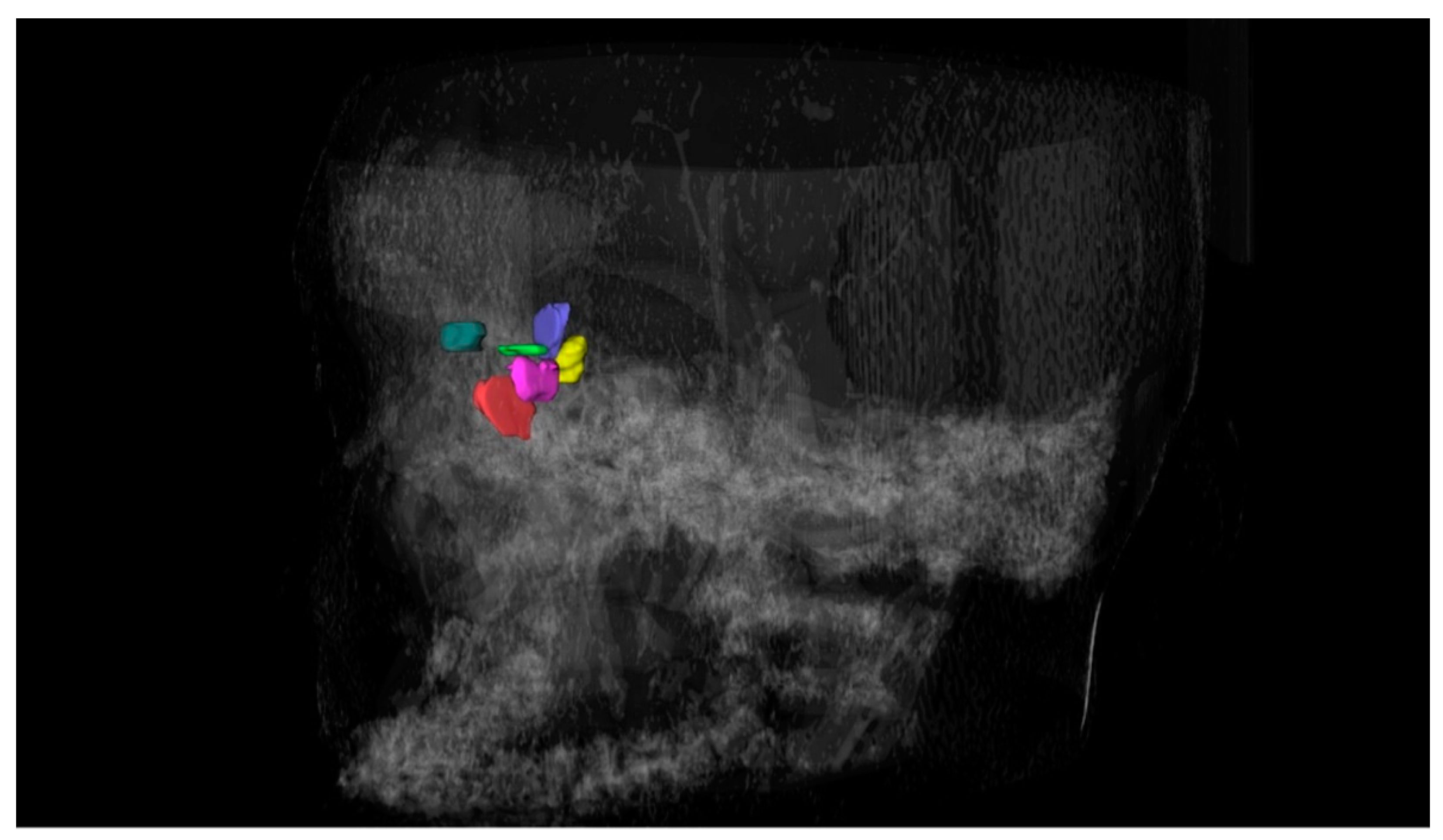 Tomography 08 00233 g002
