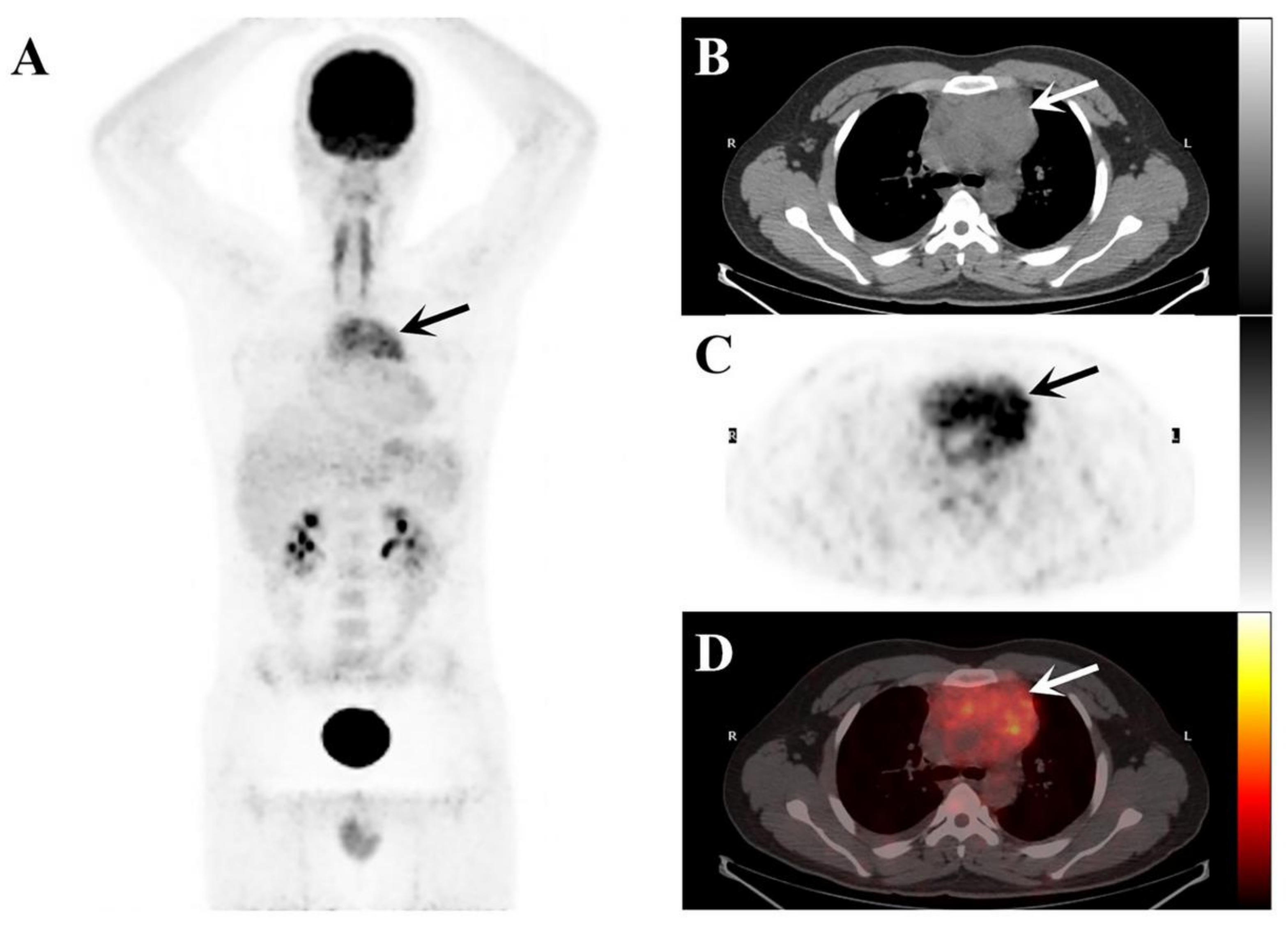 Tomography 08 00237 g002