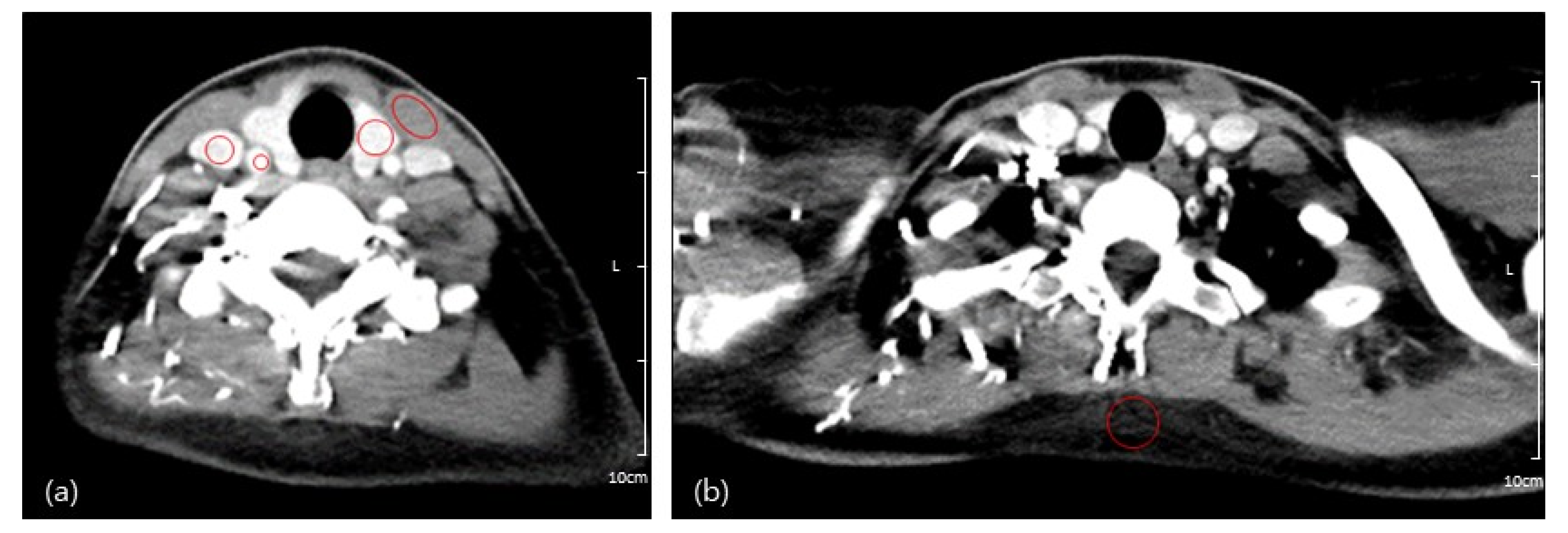 Tomography 08 00239 g002