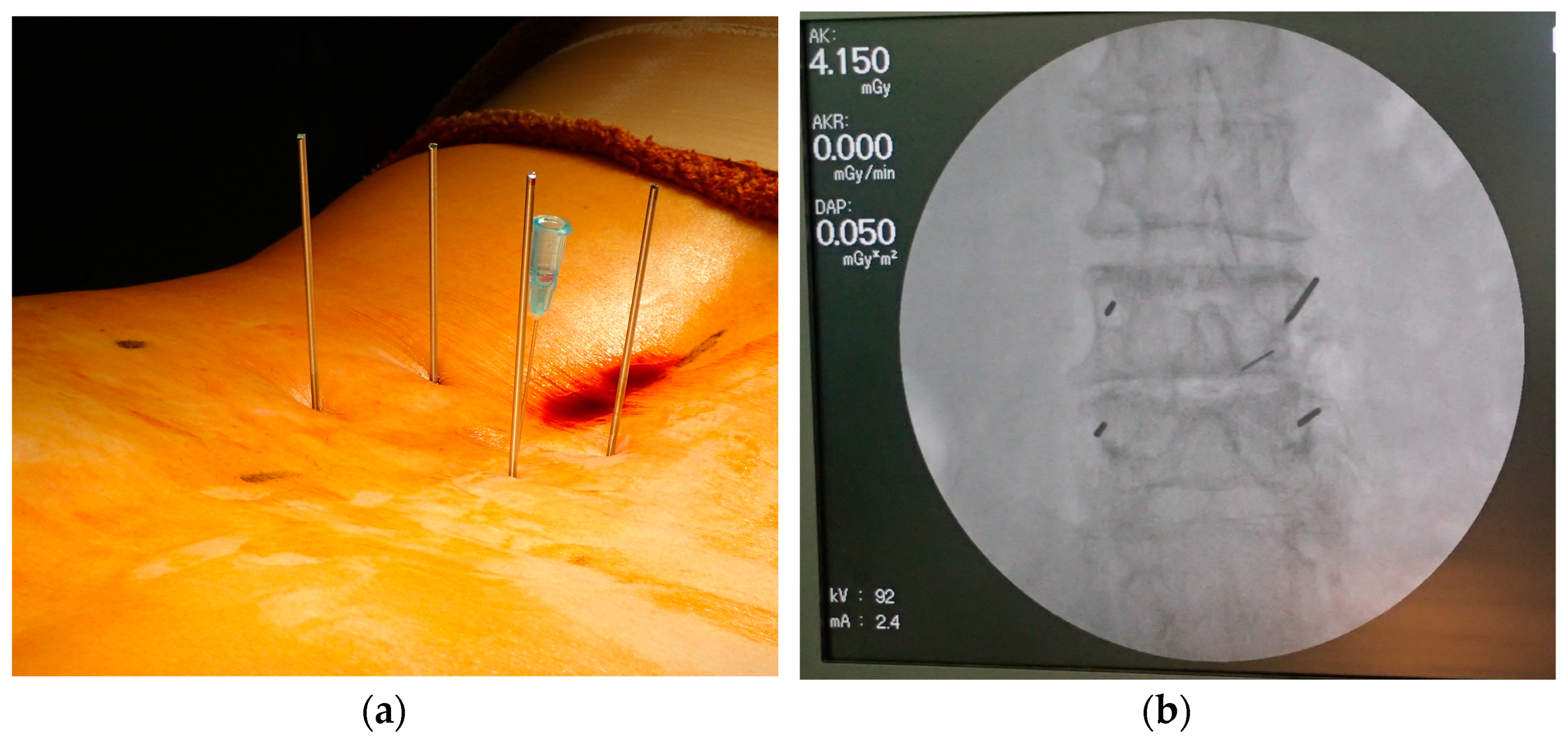 Tomography 09 00002 g002