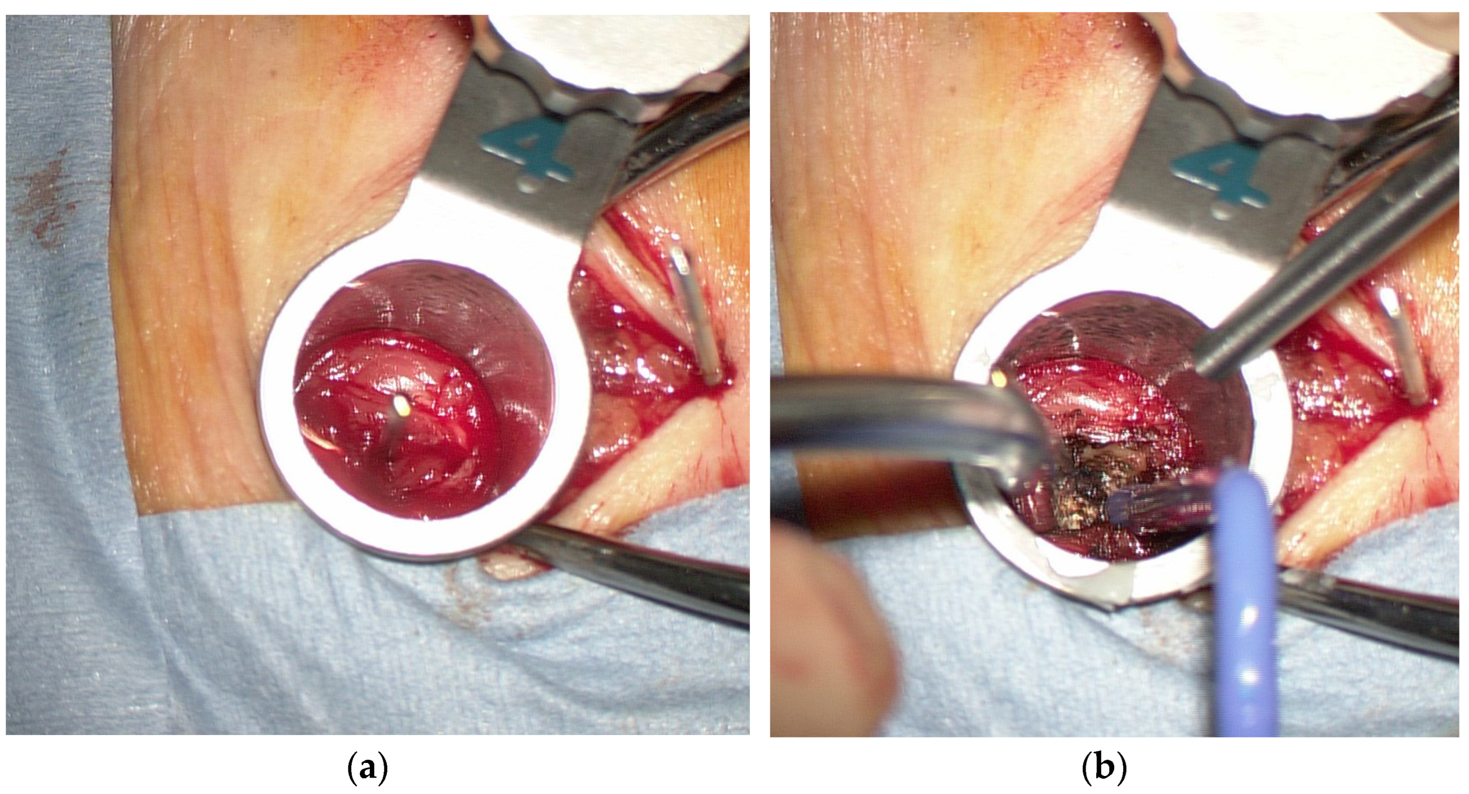 Tomography 09 00002 g003