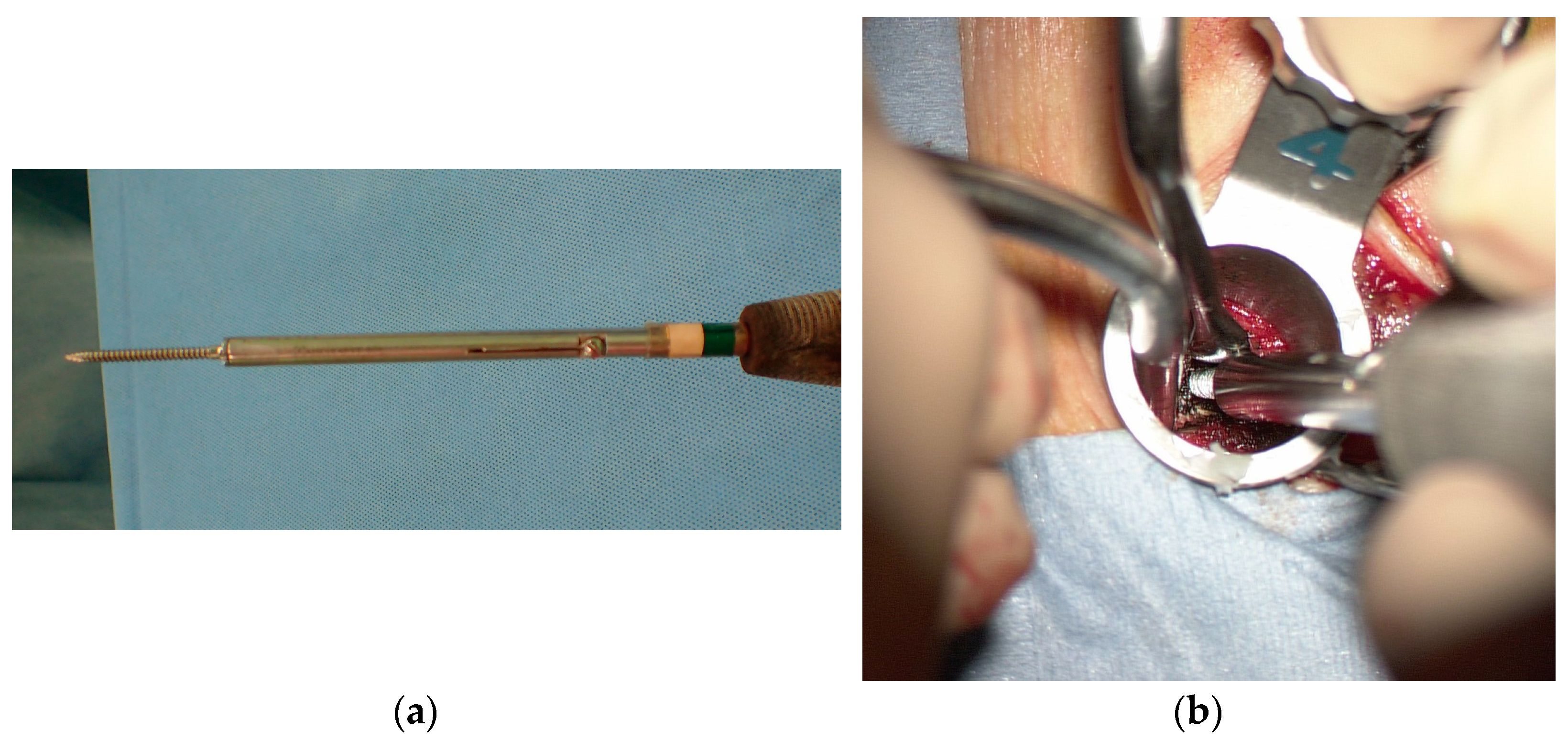 Tomography 09 00002 g004