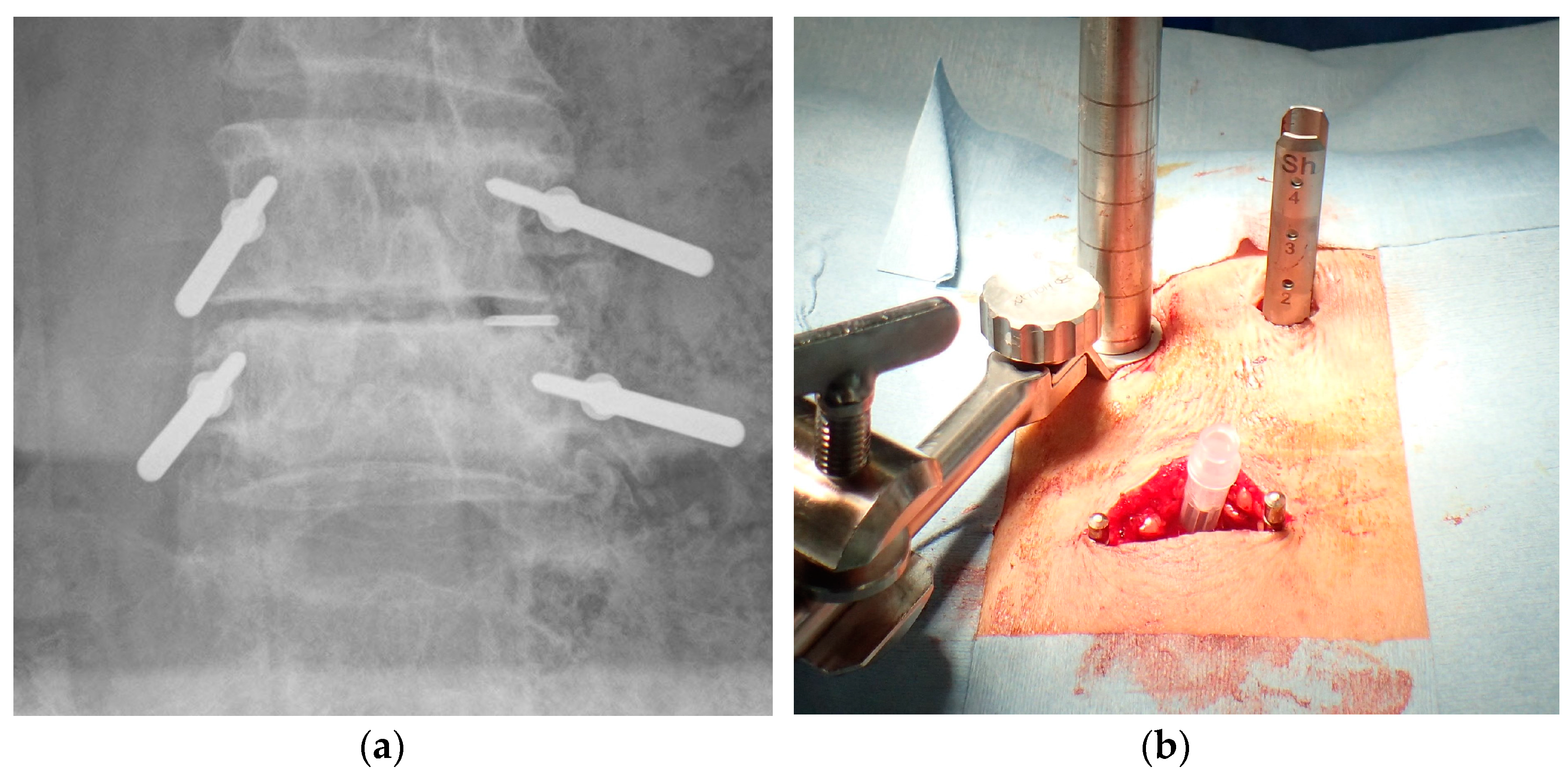 Tomography 09 00002 g005