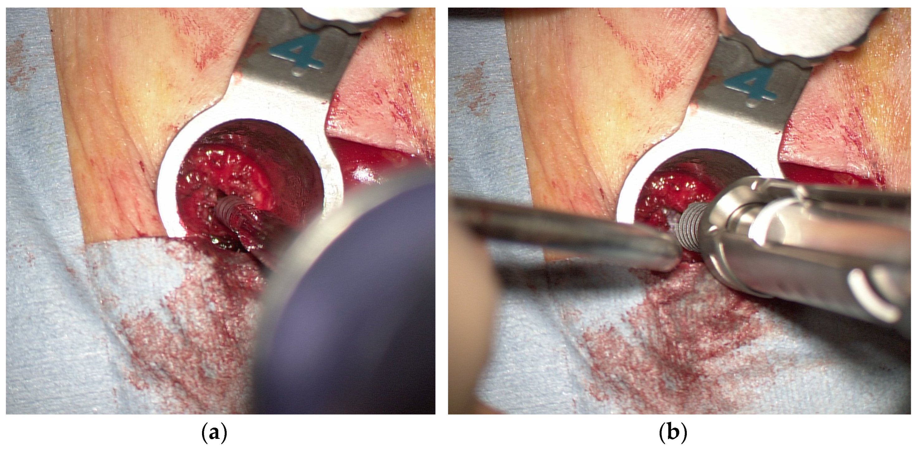 Tomography 09 00002 g006