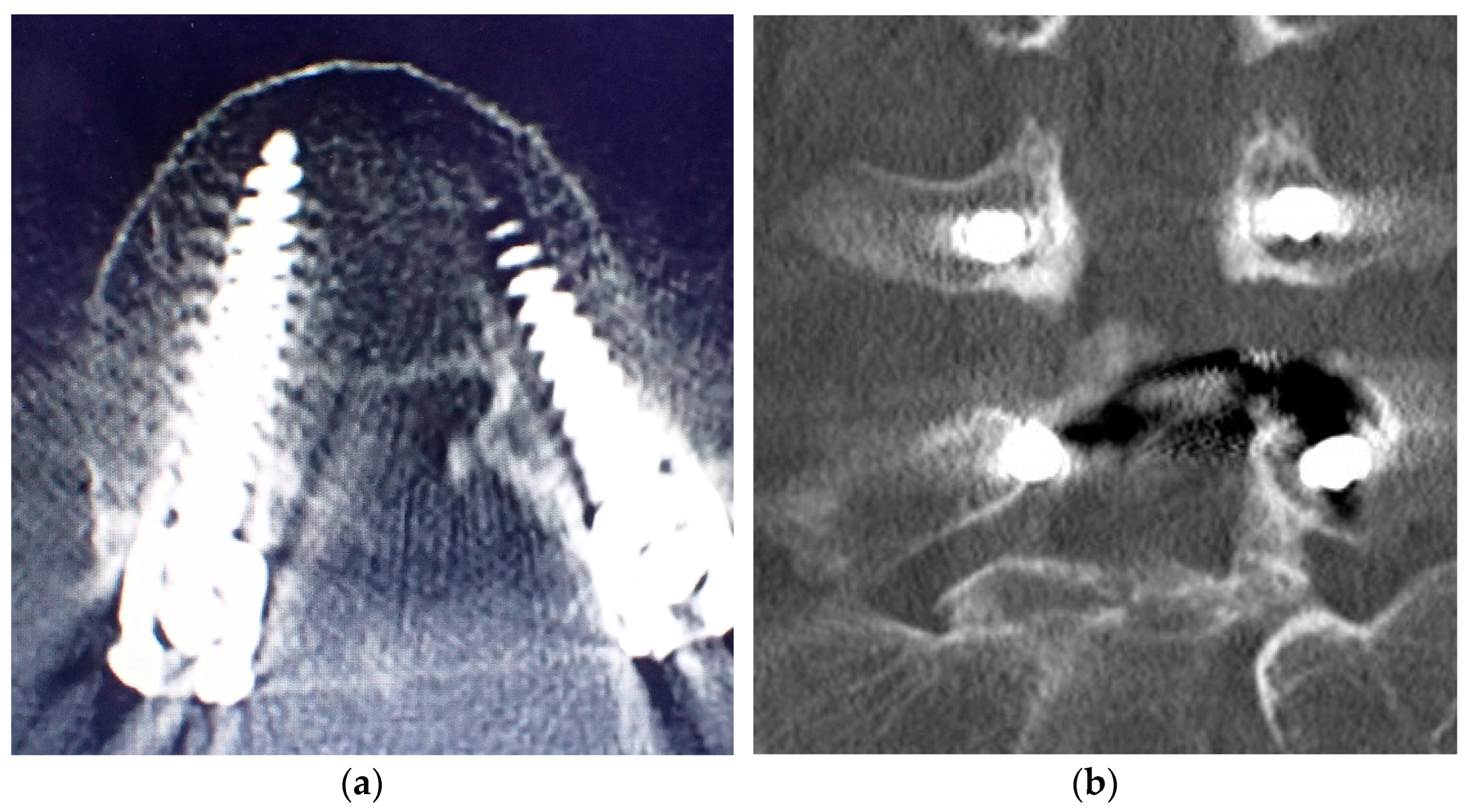 Tomography 09 00002 g007