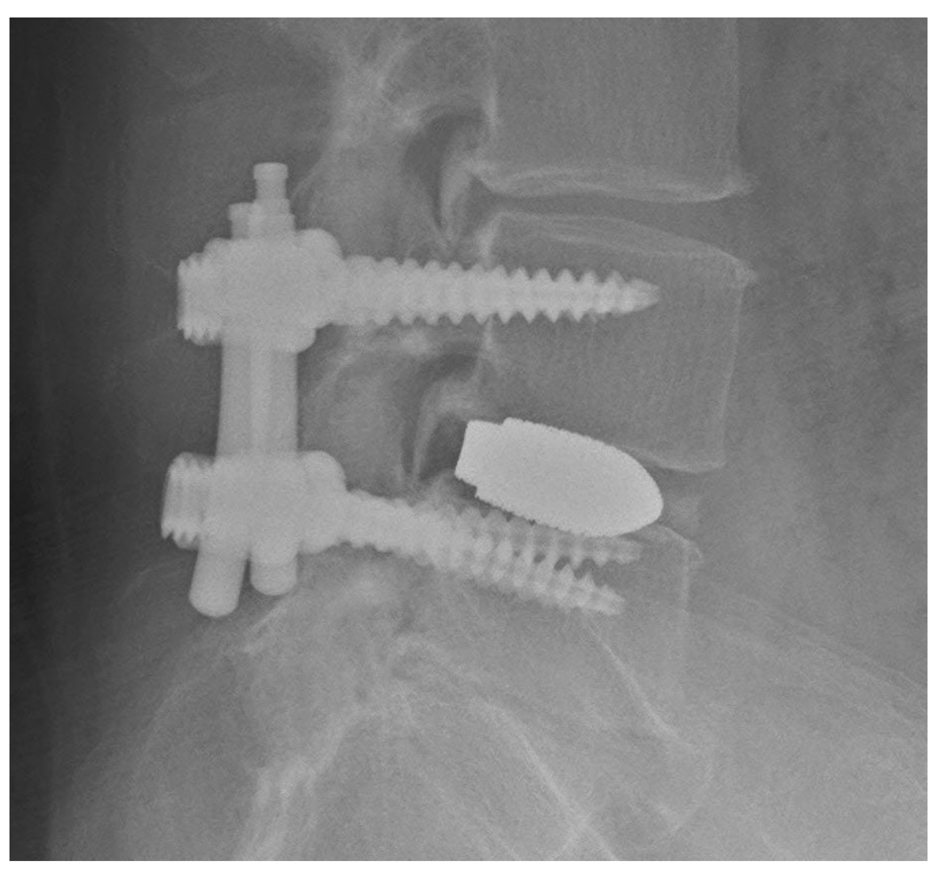 Tomography 09 00002 g008