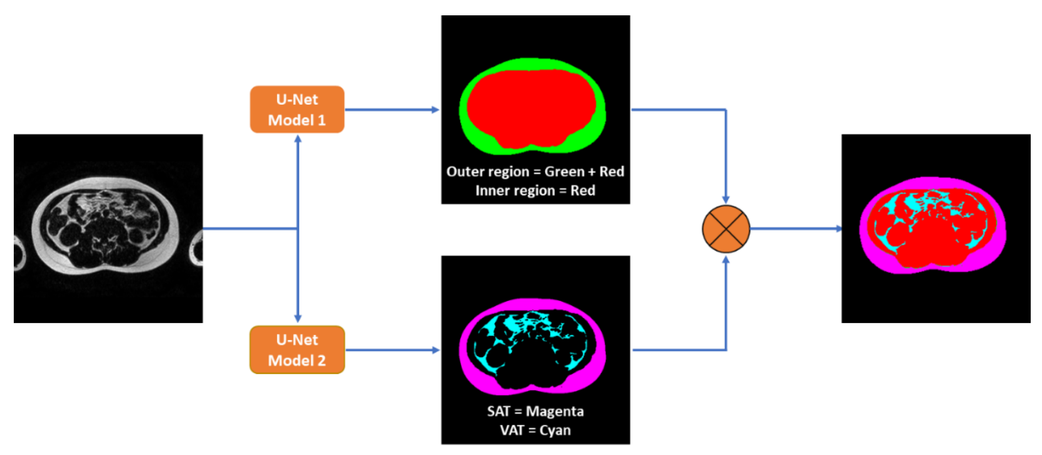 Tomography 09 00012 g001