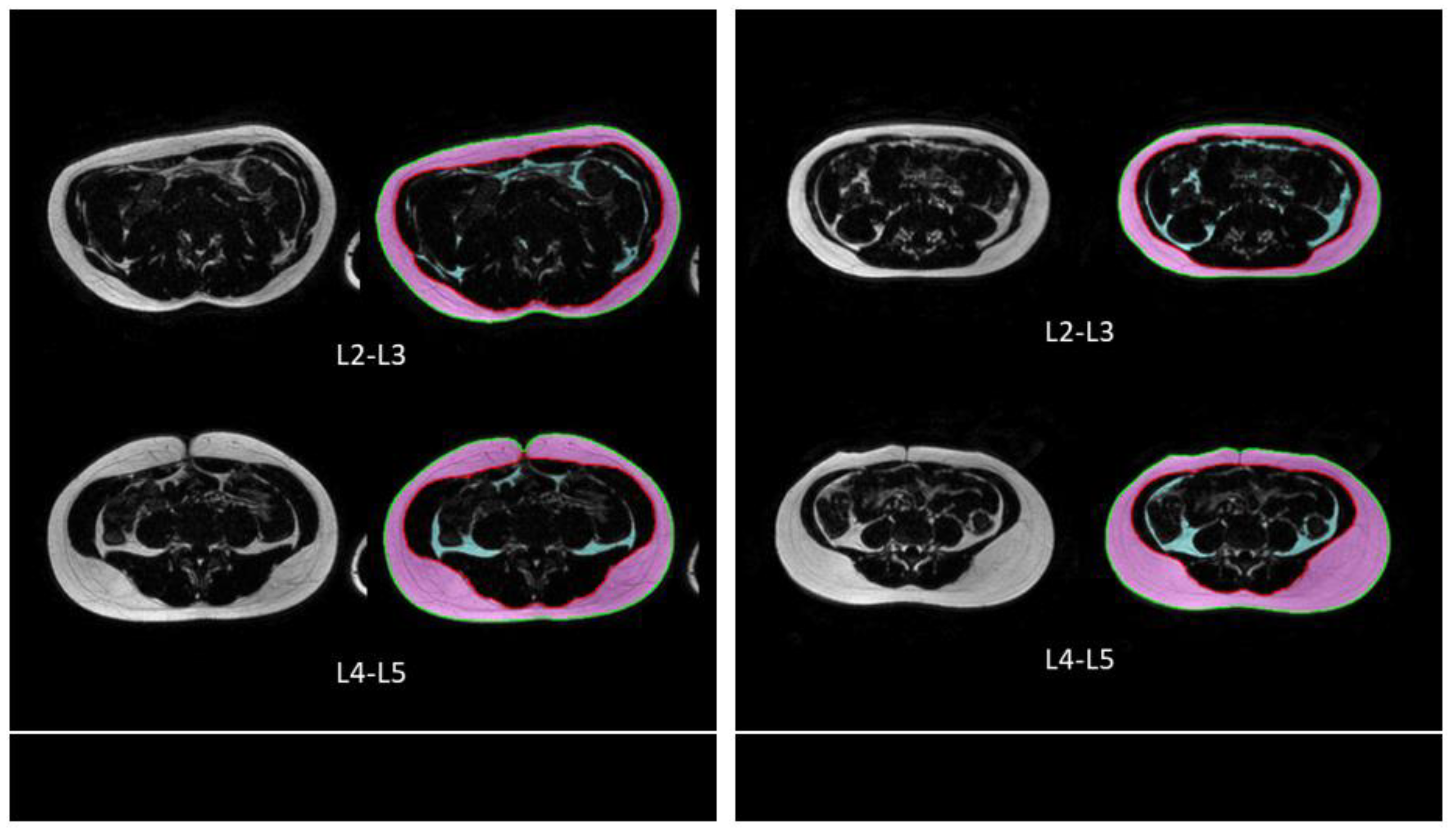 Tomography 09 00012 g002