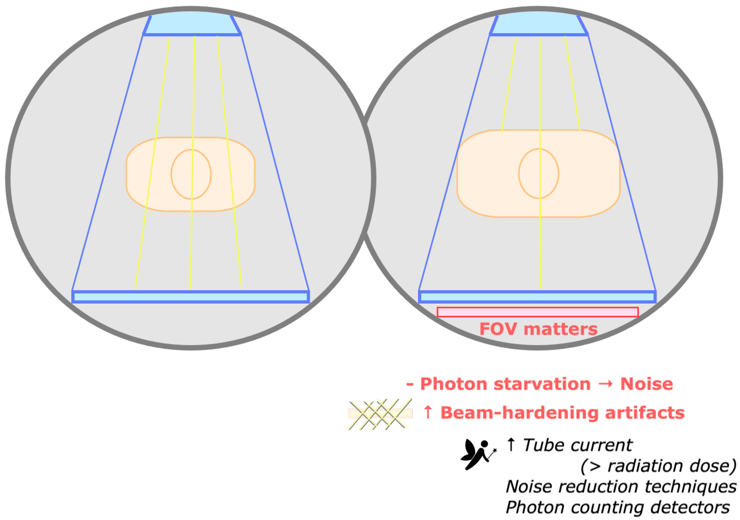 Tomography 09 00017 g012