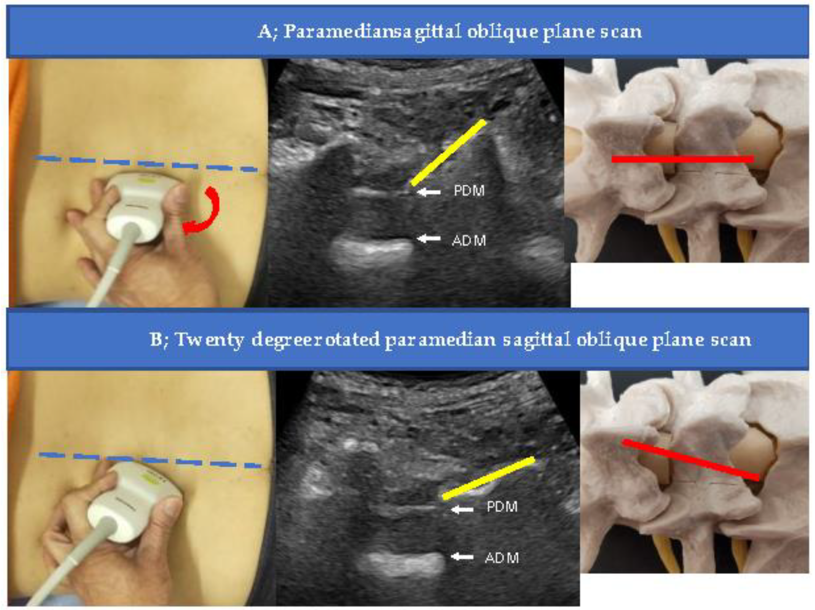 Tomography 09 00023 g003