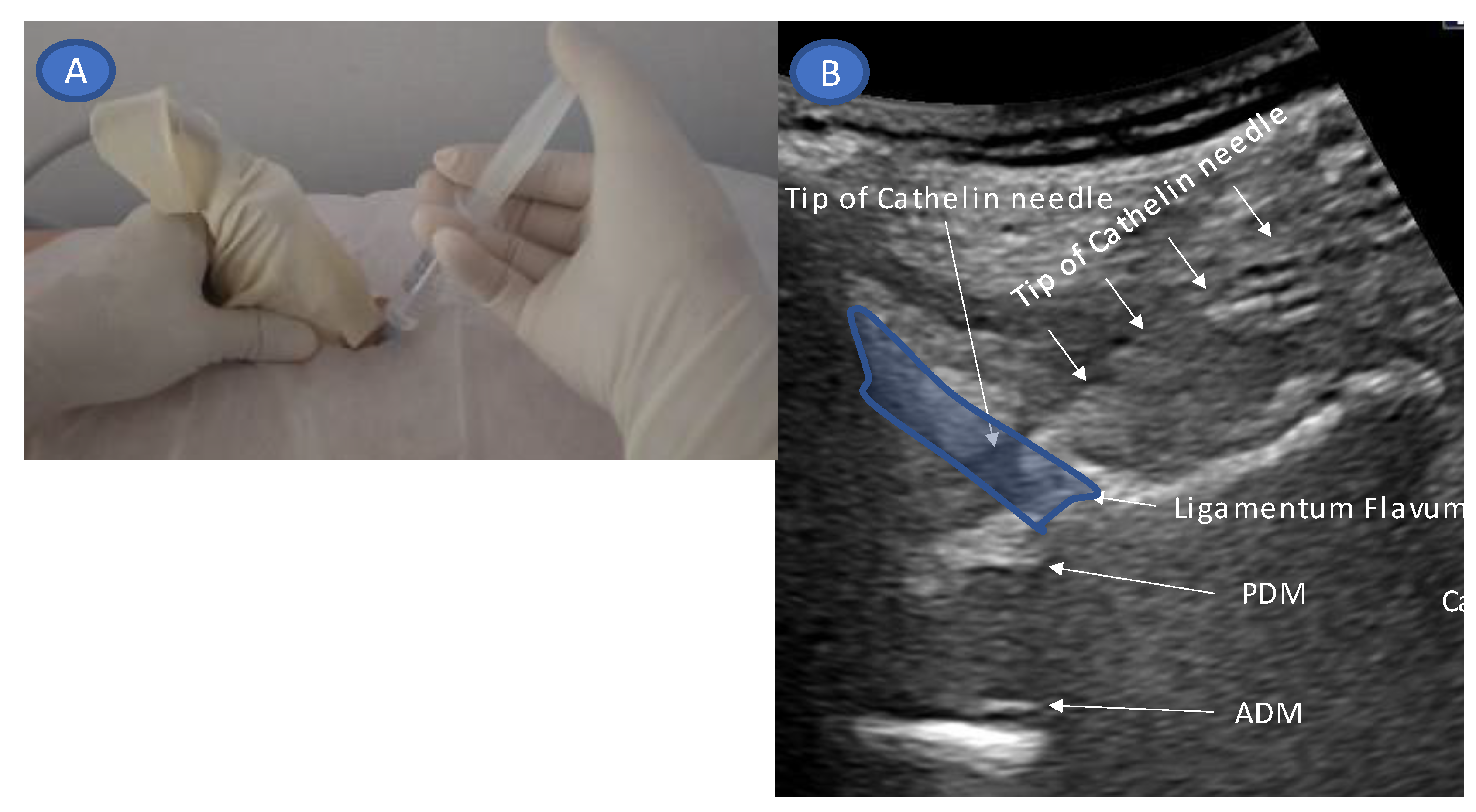 Tomography 09 00023 g004
