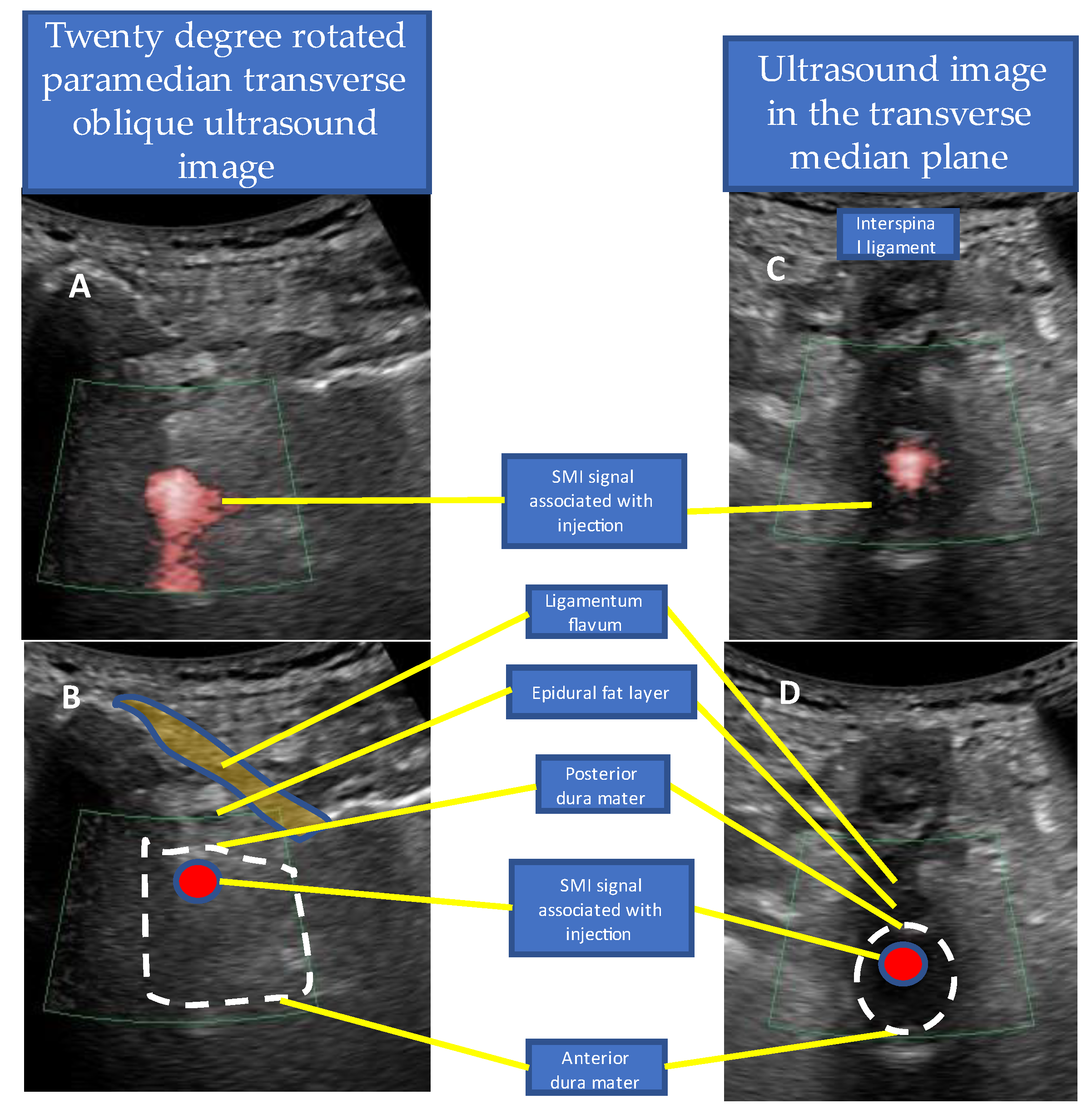 Tomography 09 00023 g006