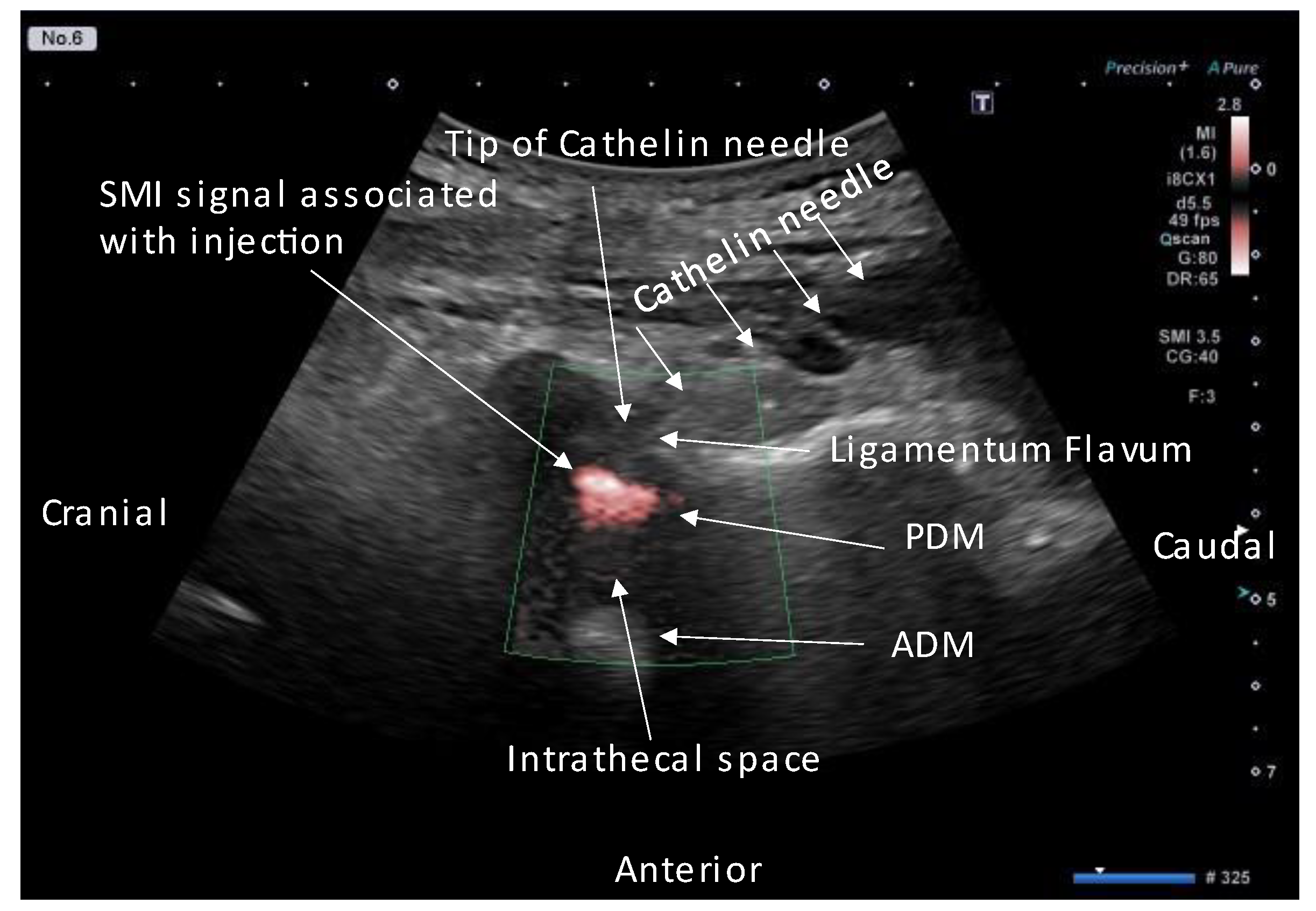 Tomography 09 00023 g008