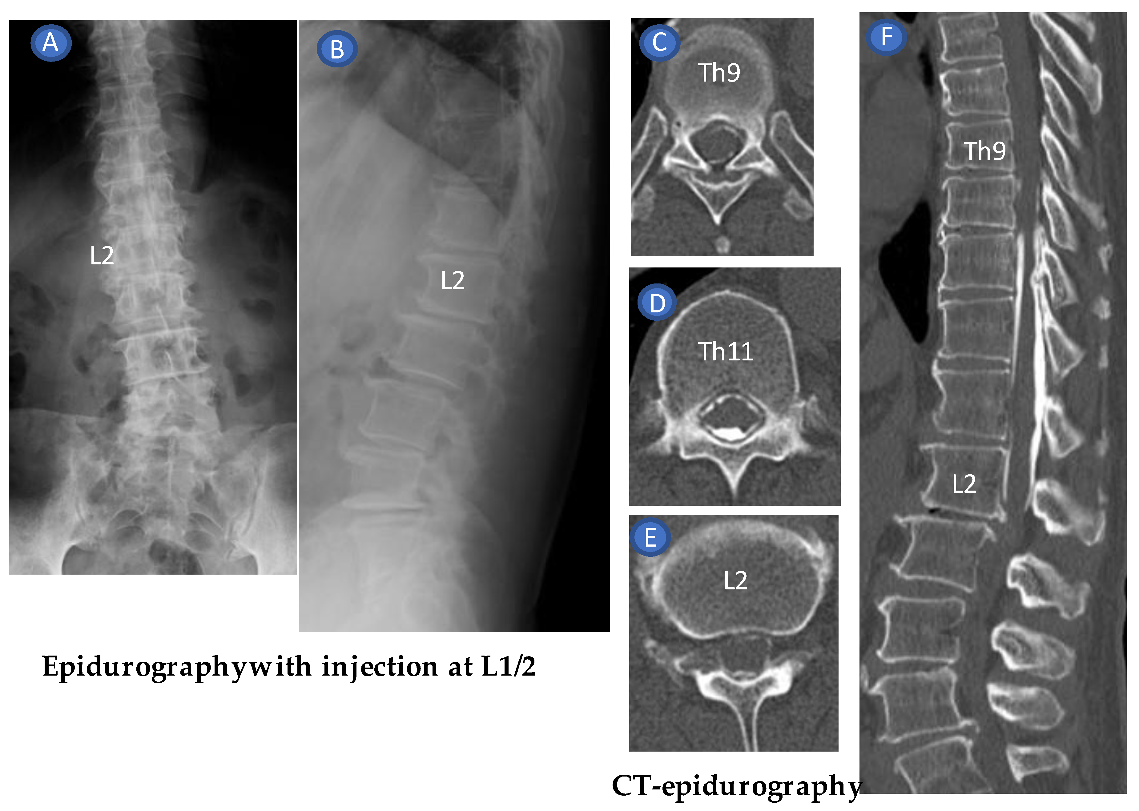 Tomography 09 00023 g010