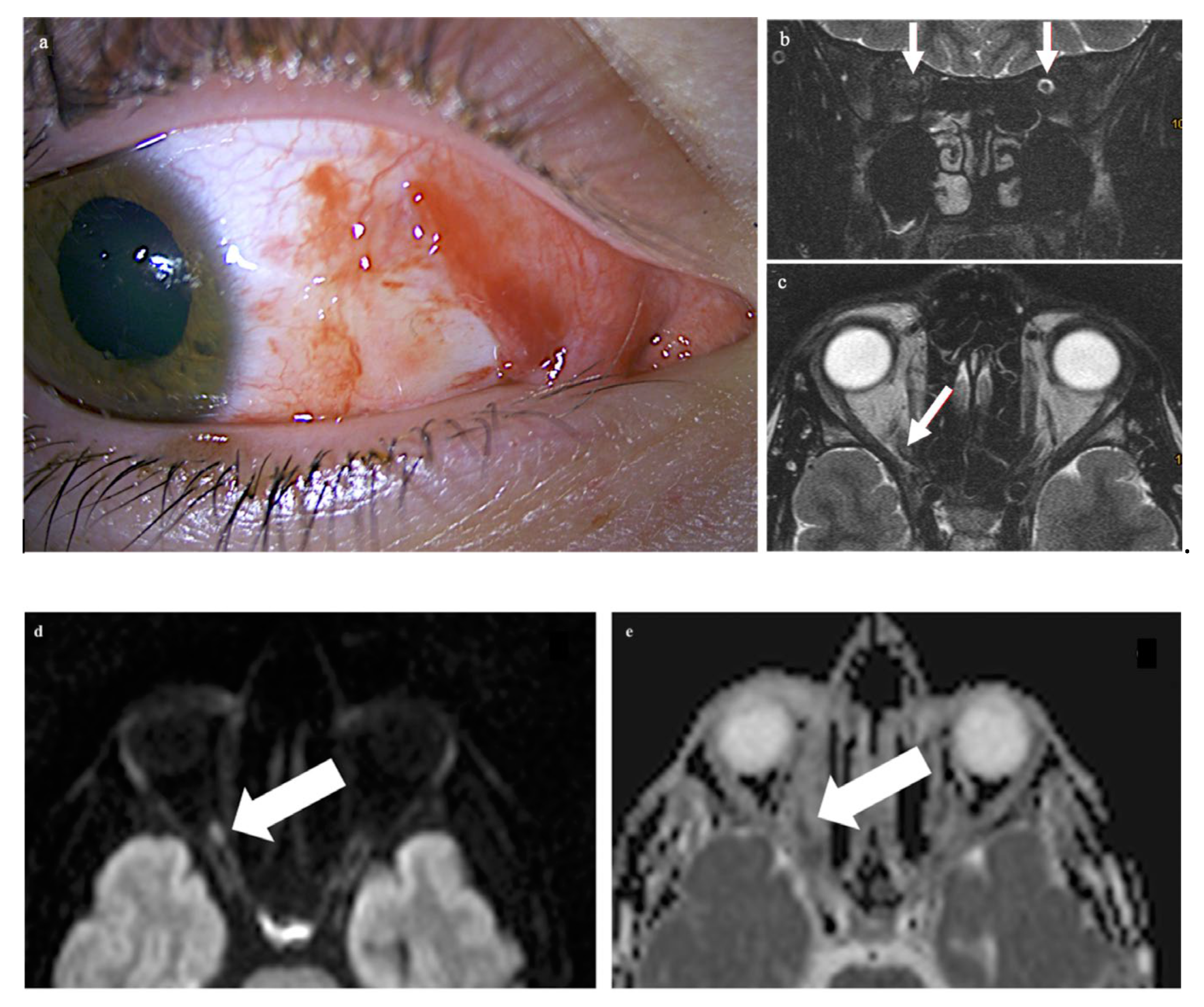 Tomography 09 00033 g001a