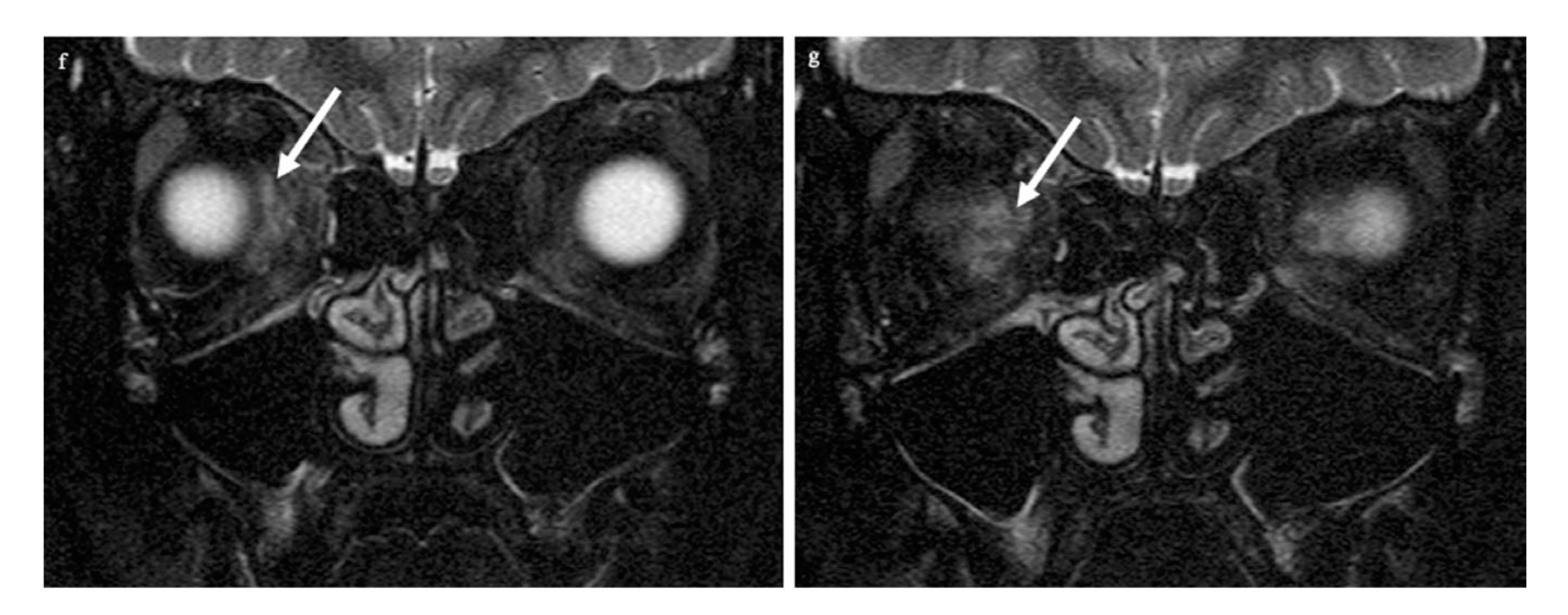 Tomography 09 00033 g001b