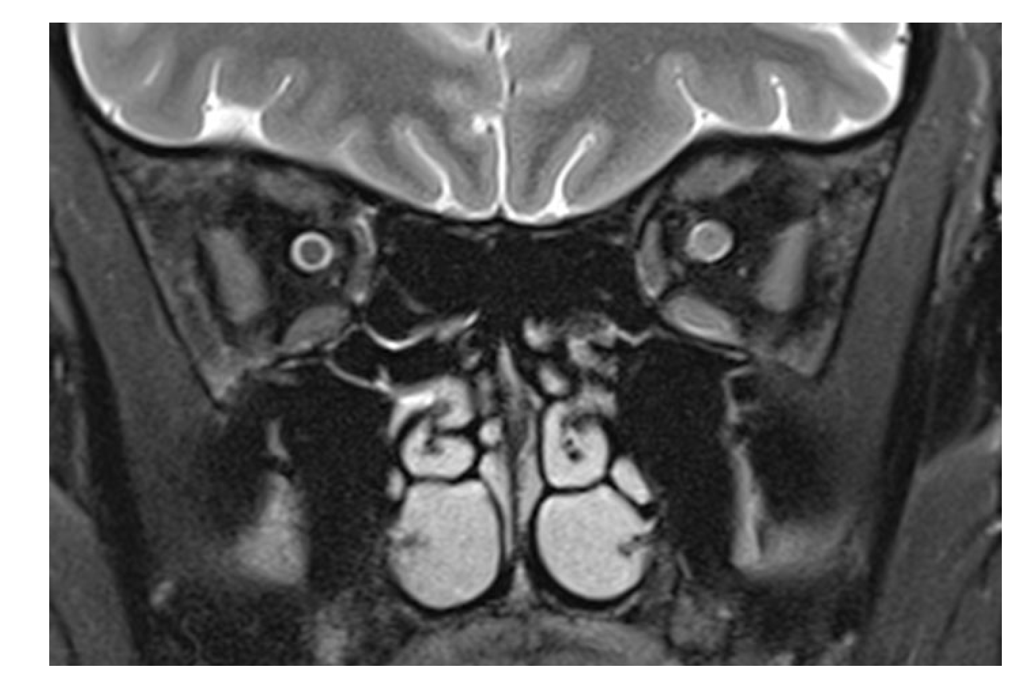 Tomography 09 00033 g002