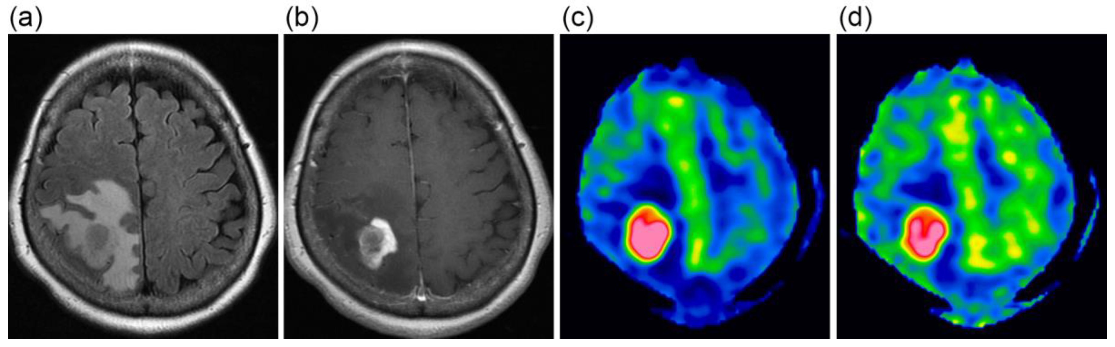 Tomography 09 00036 g001