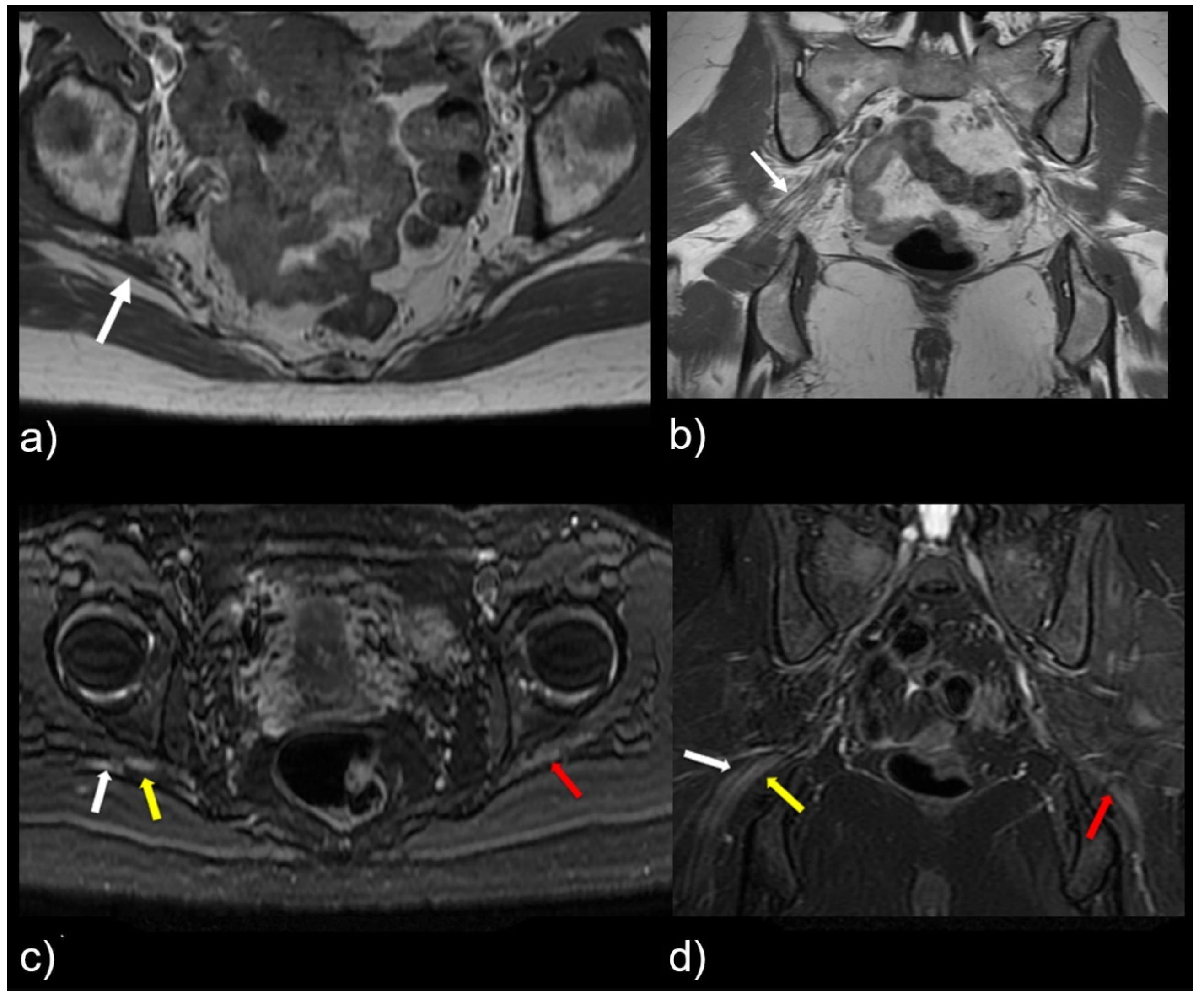 Tomography 09 00039 g004