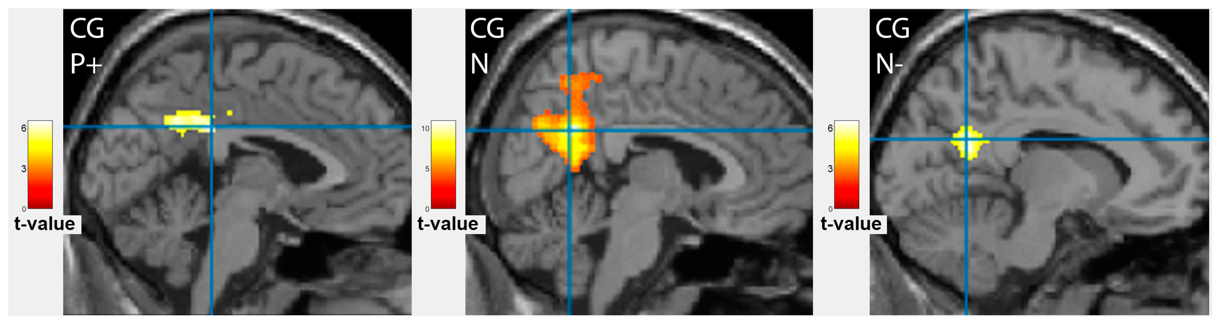 Tomography 09 00043 g006