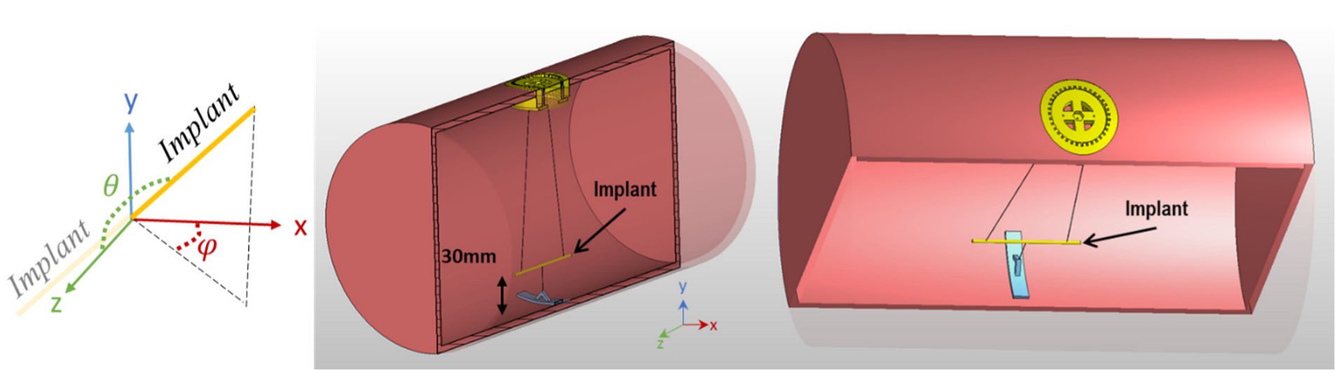 Tomography 09 00049 g002 Tomography 09 00049 g002