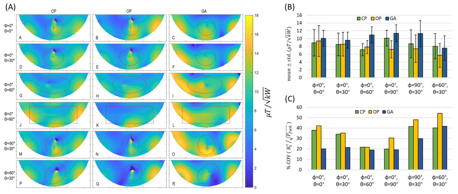 Tomography 09 00049 g007 Tomography 09 00049 g007