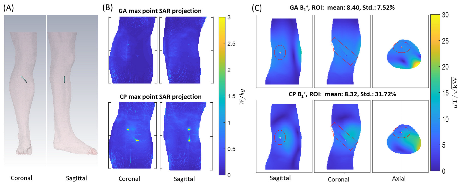 Tomography 09 00049 g009 Tomography 09 00049 g009
