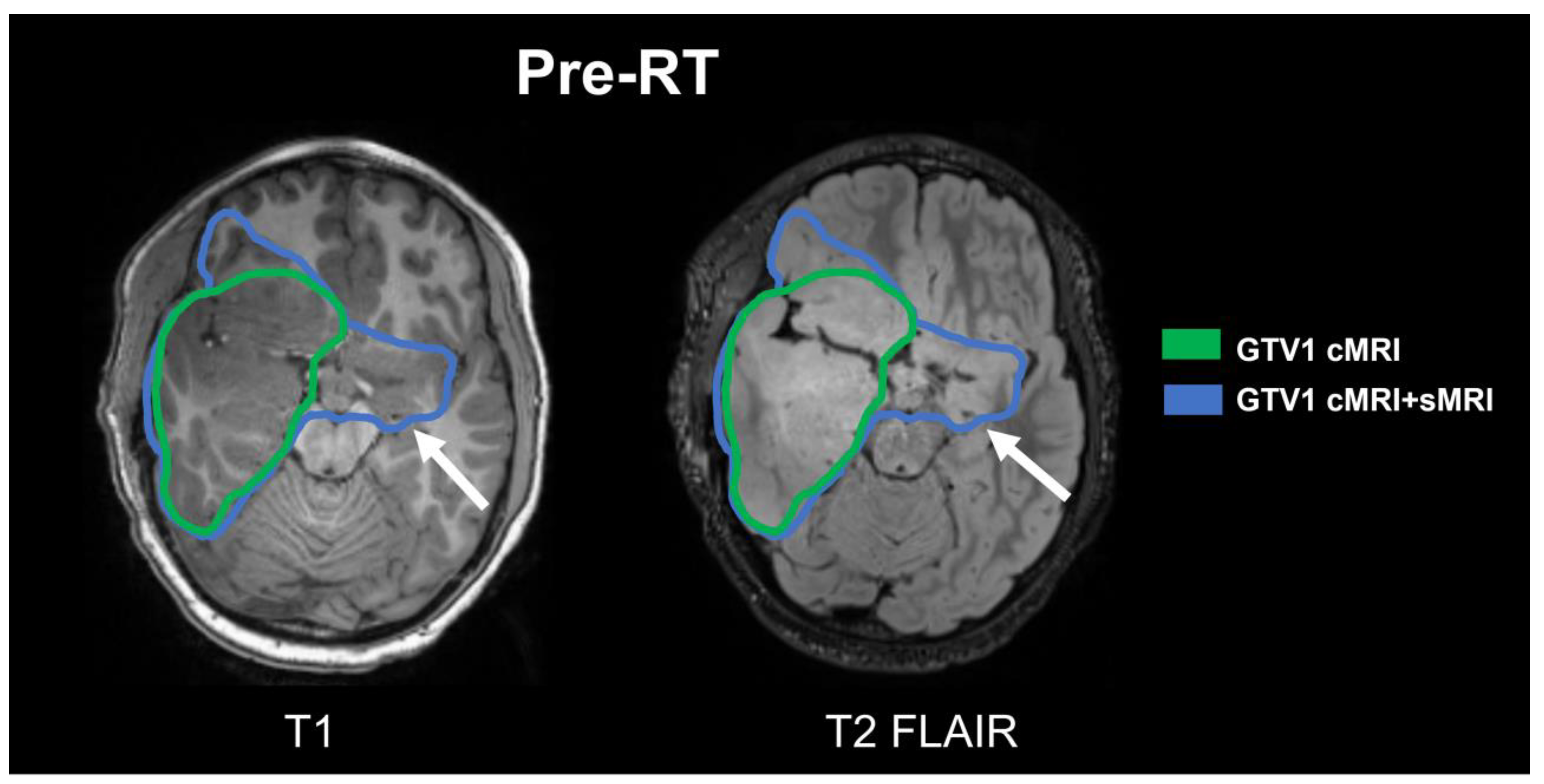 Tomography 09 00051 g002
