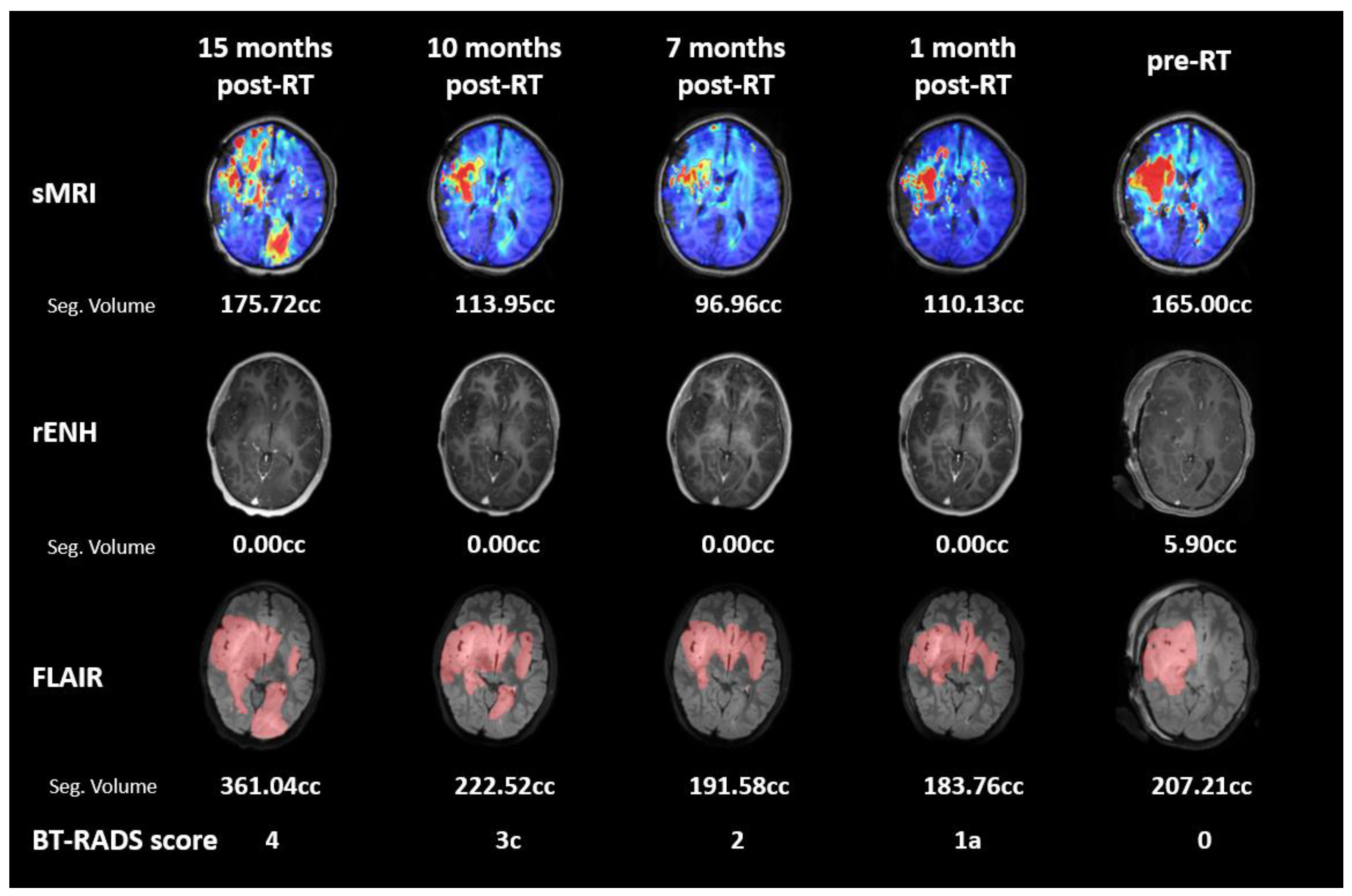 Tomography 09 00051 g004