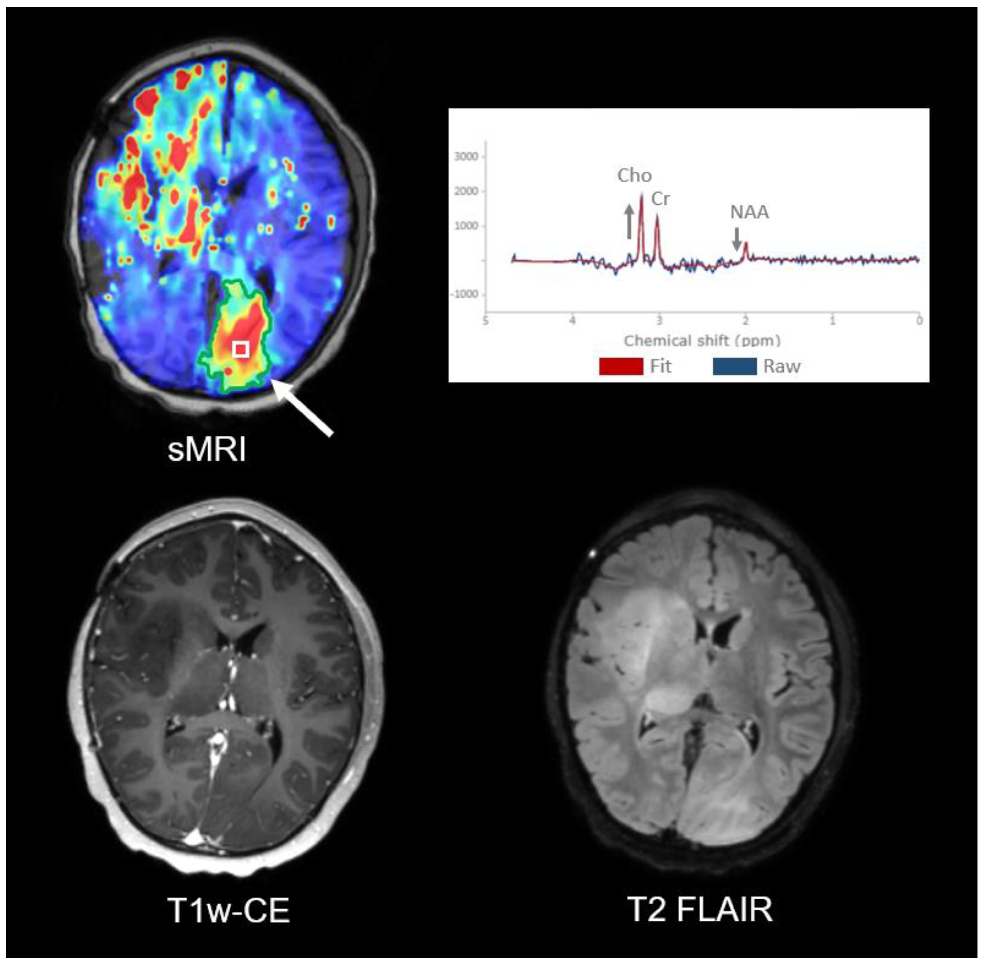 Tomography 09 00051 g005