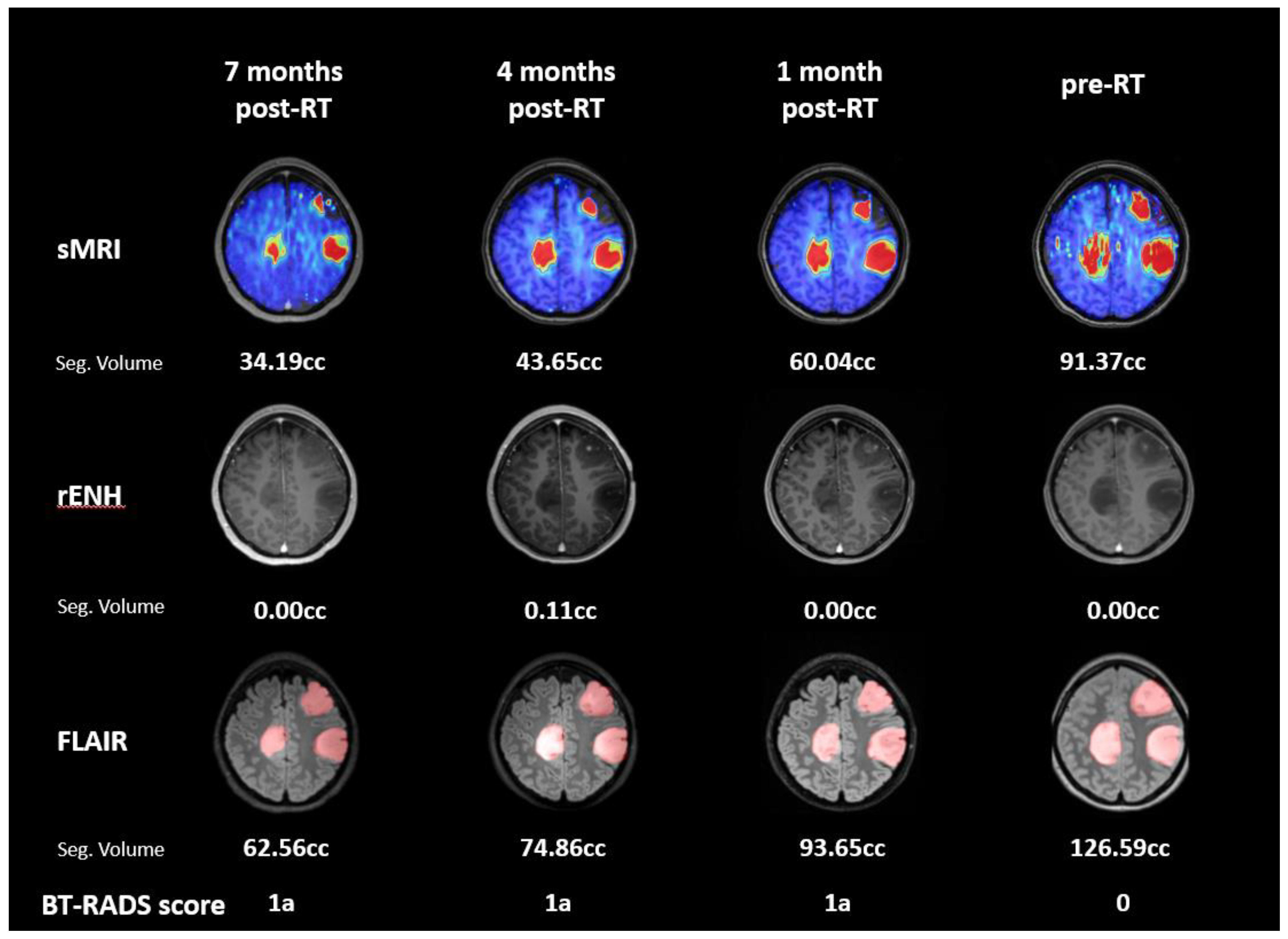 Tomography 09 00051 g006