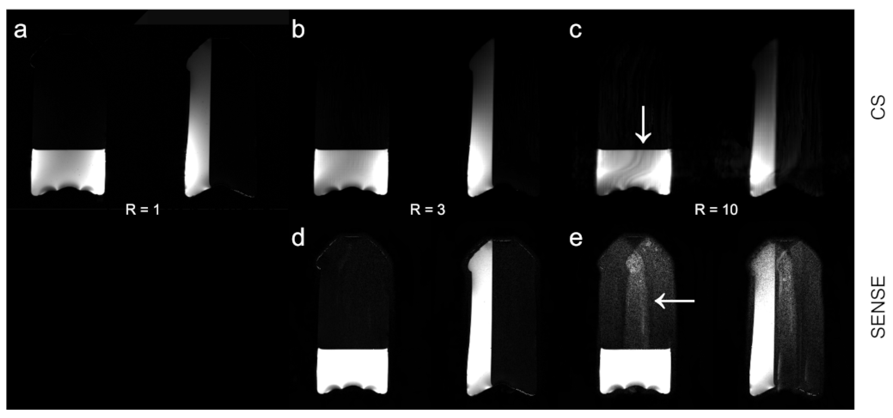 Tomography 09 00055 g004