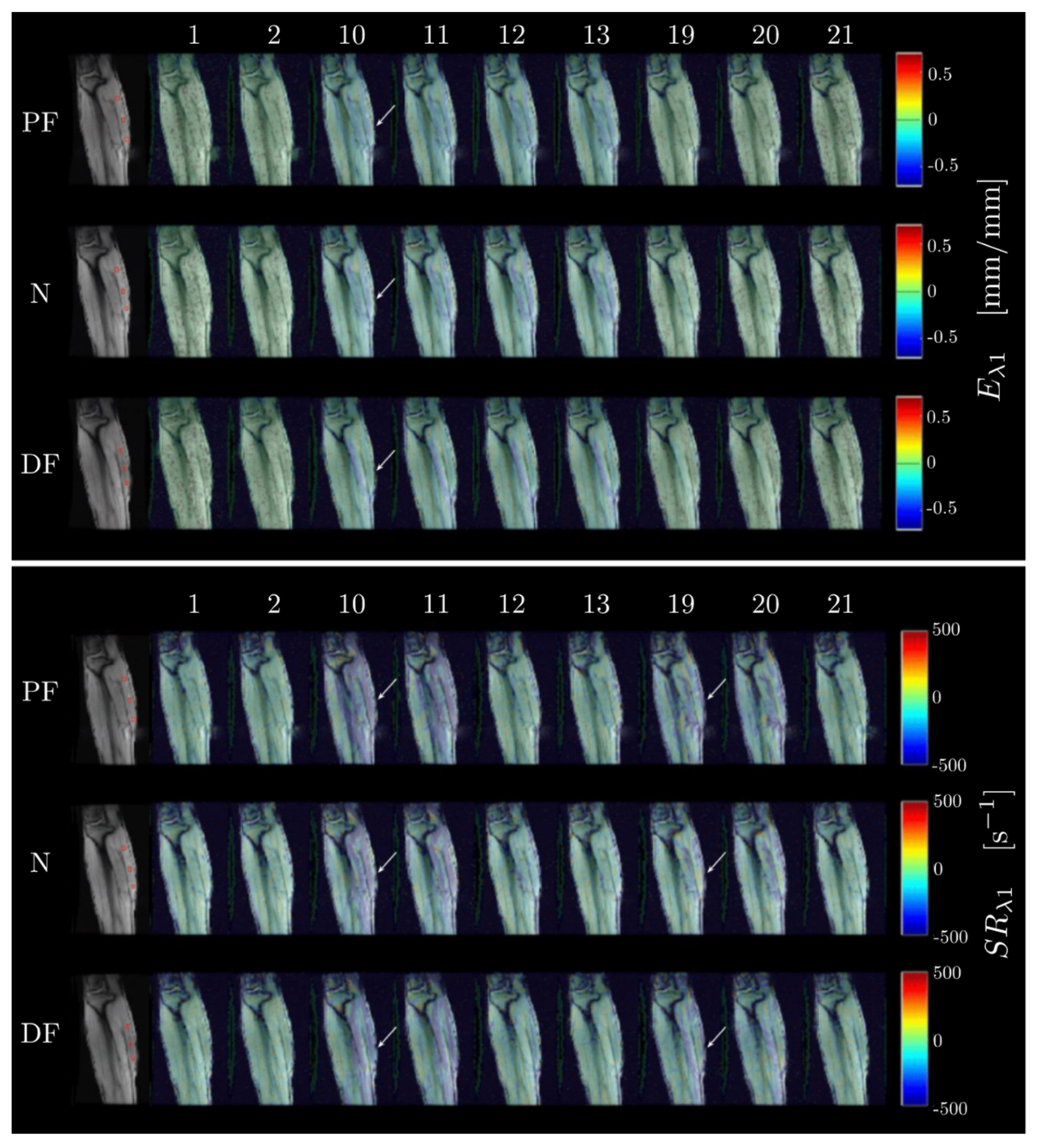 Tomography 09 00068 g003
