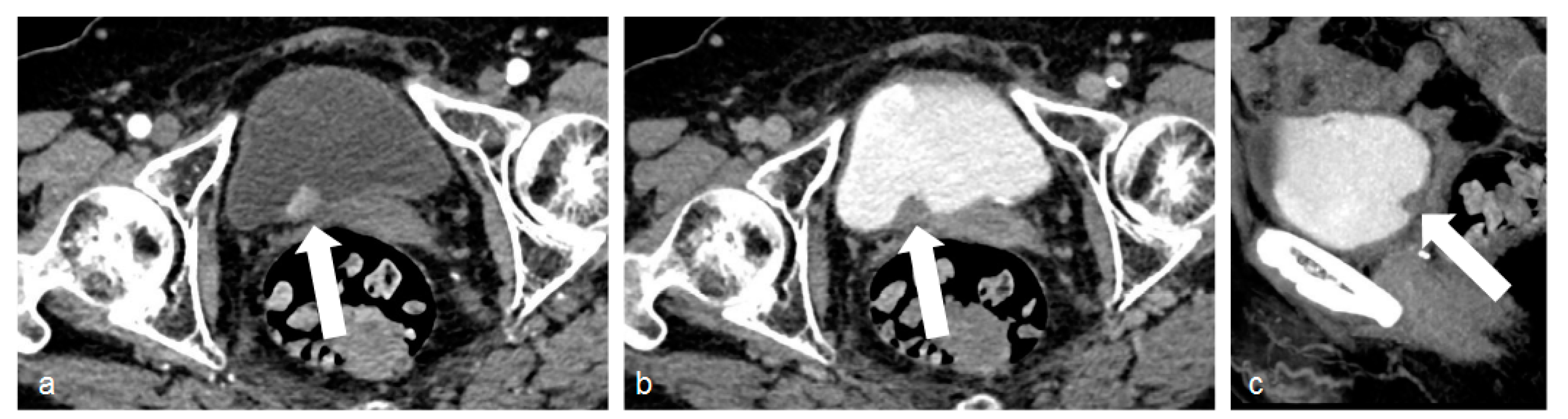 Tomography 09 00075 g001