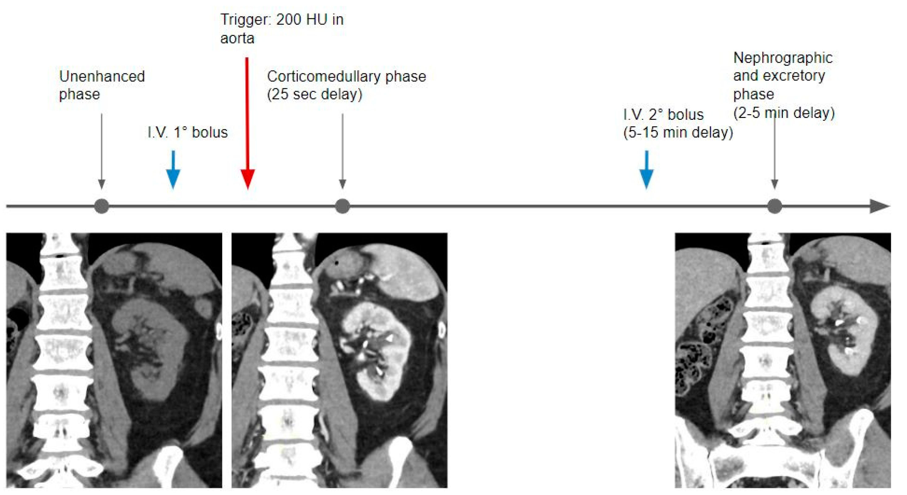 Tomography 09 00075 g004