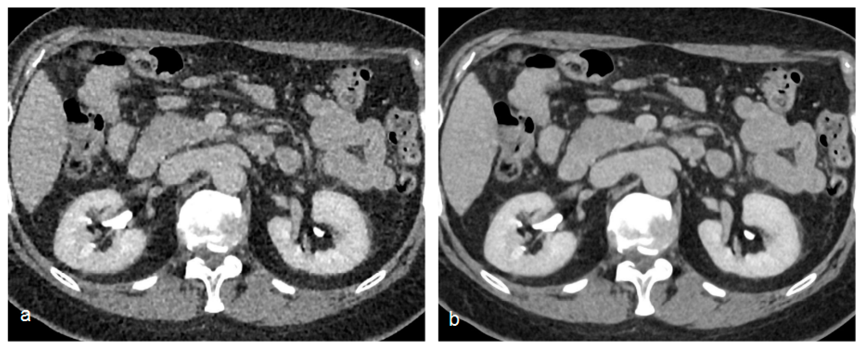 Tomography 09 00075 g006
