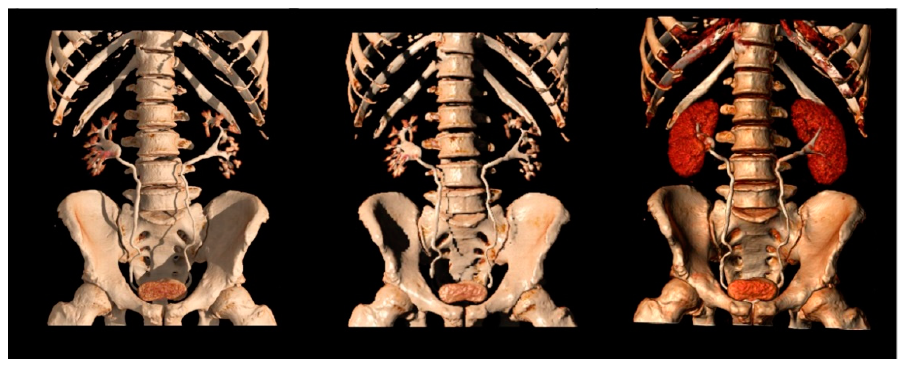 Tomography 09 00075 g007