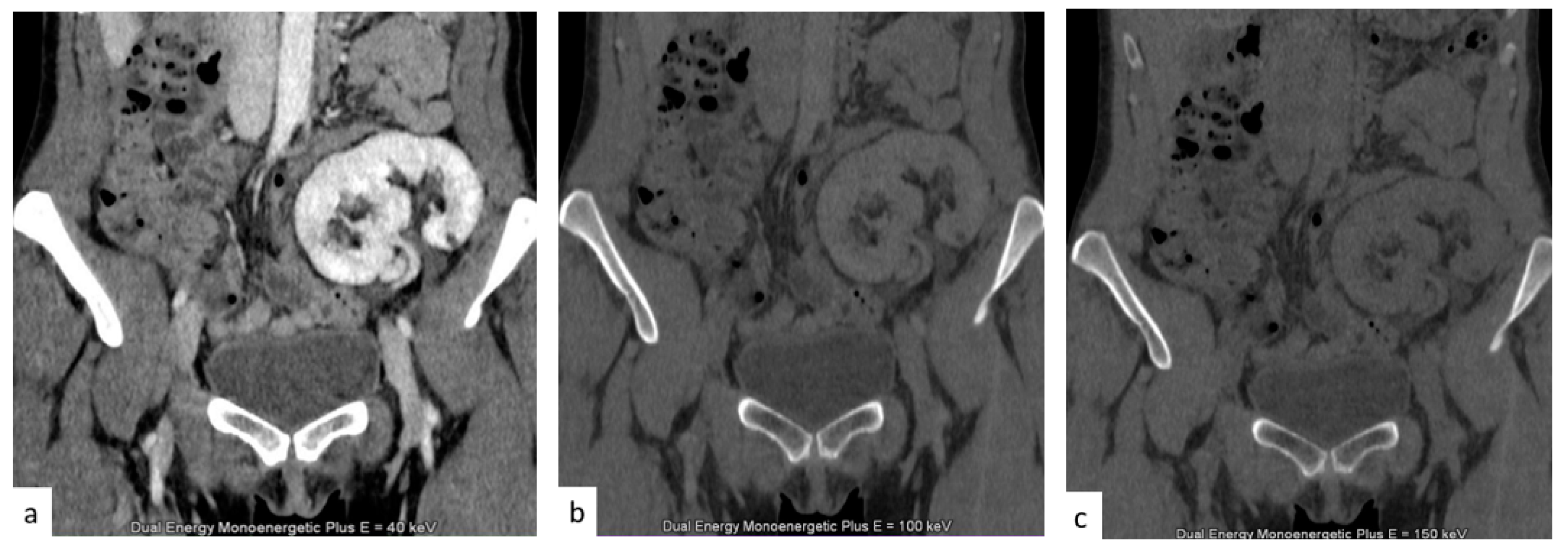 Tomography 09 00075 g008