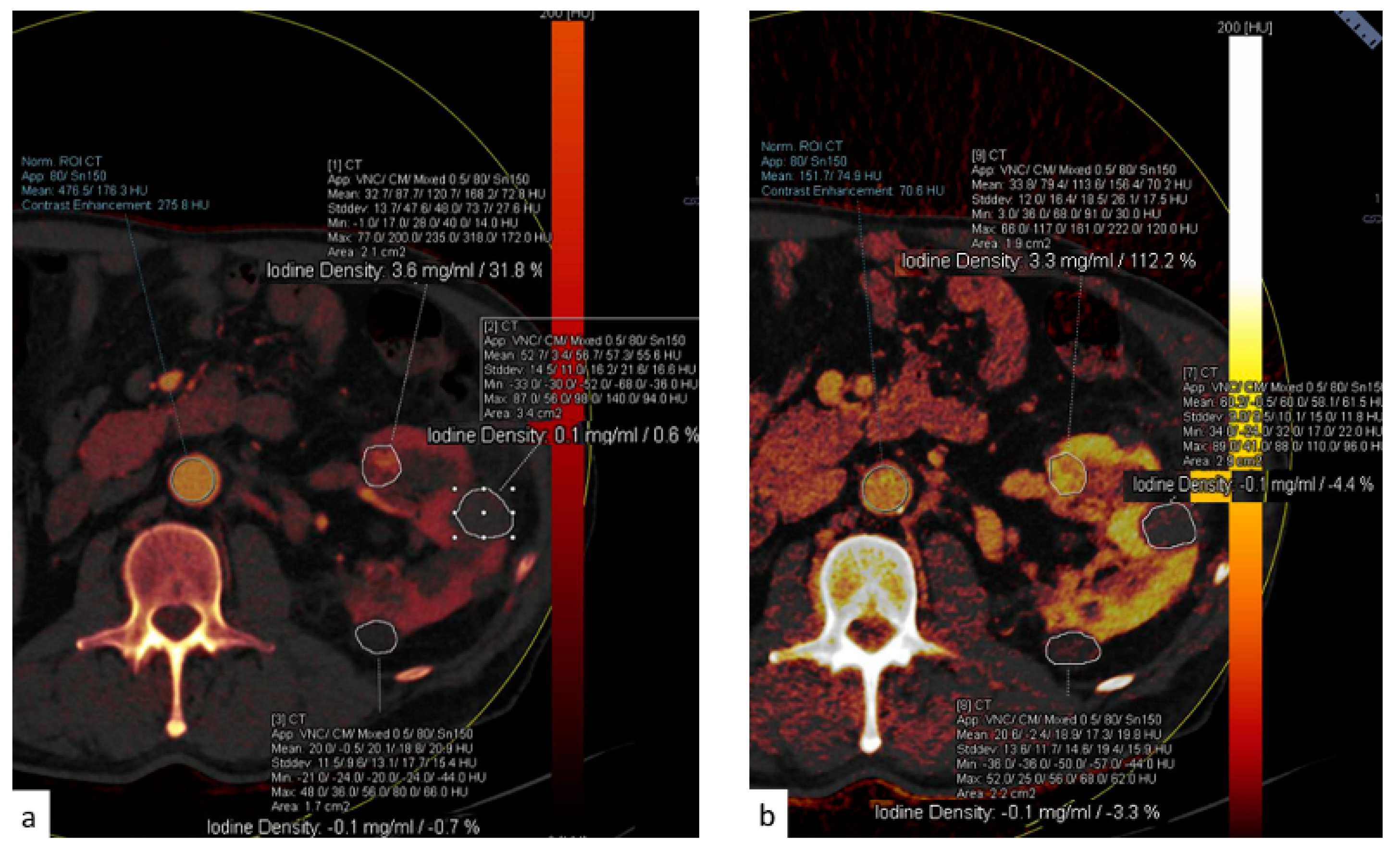 Tomography 09 00075 g012