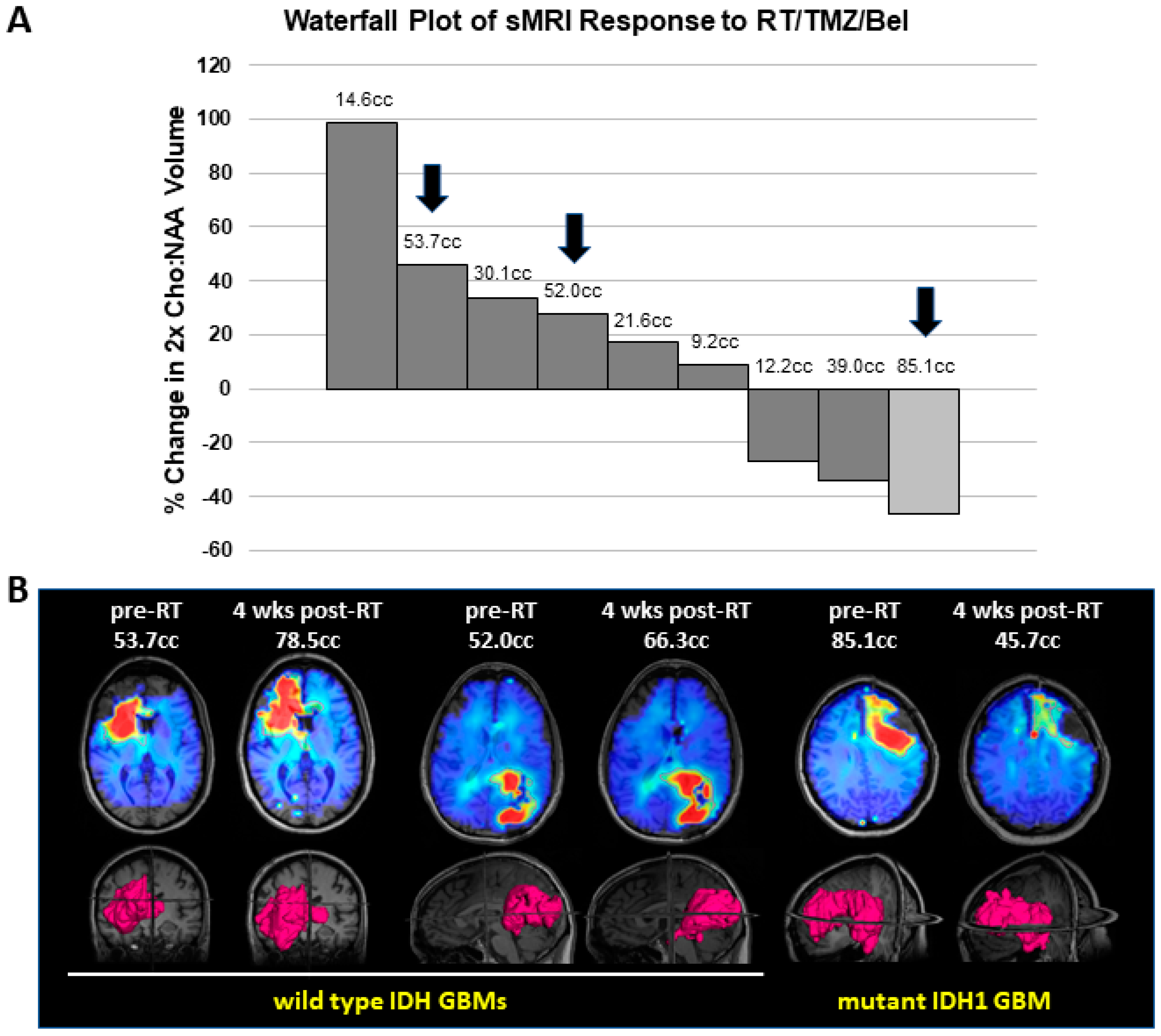 Tomography 09 00077 g005