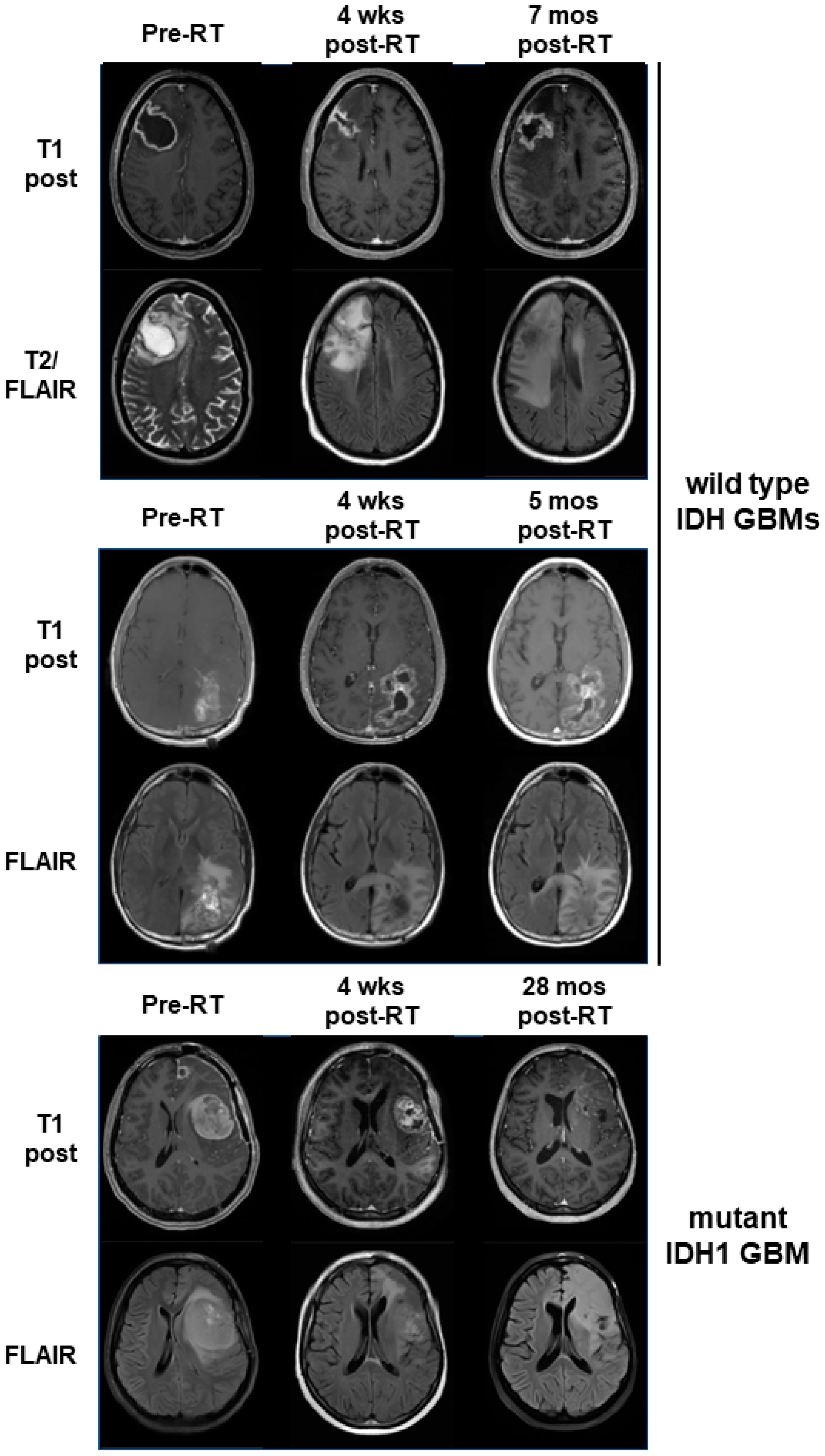 Tomography 09 00077 g006