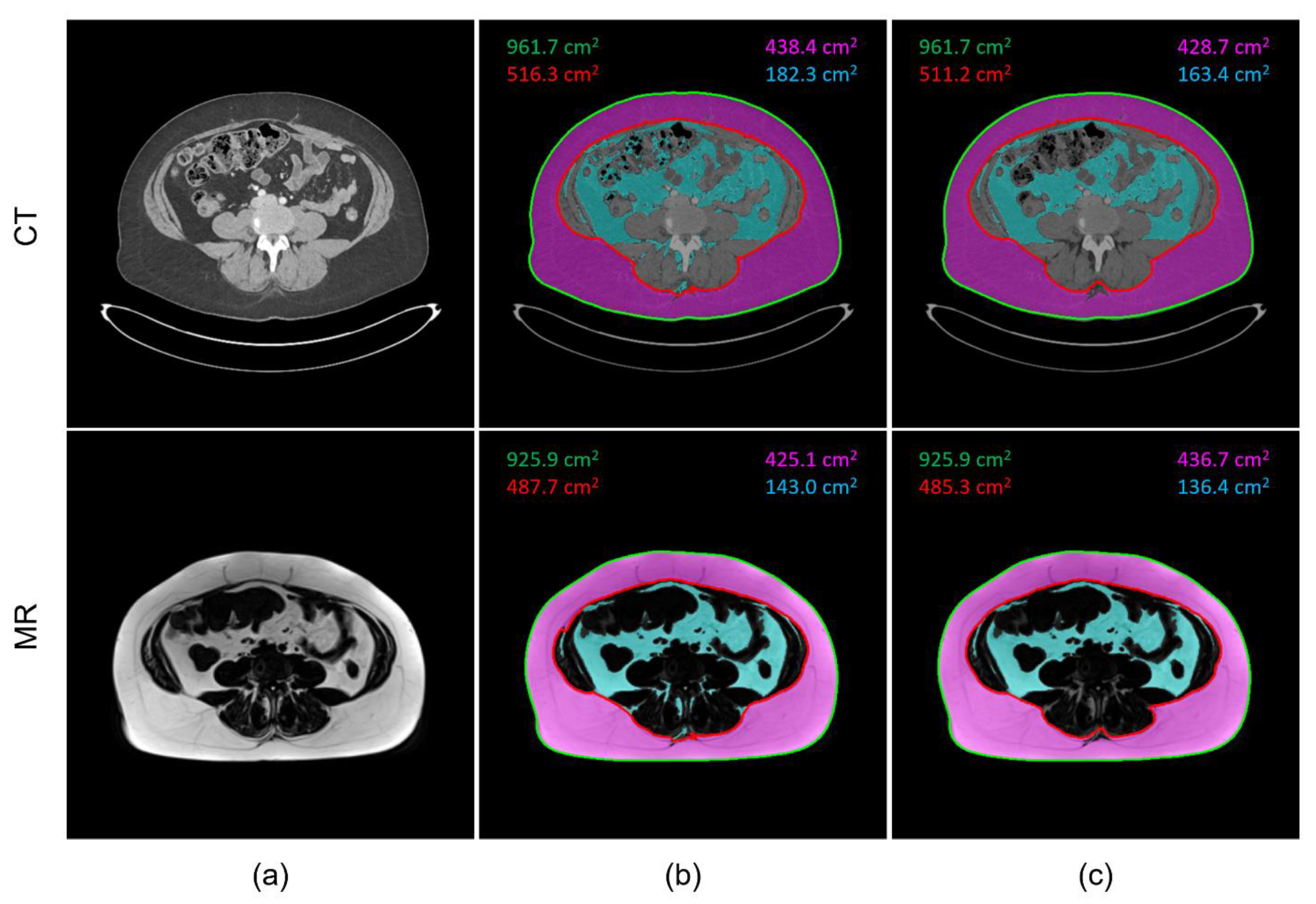 Tomography 09 00085 g002