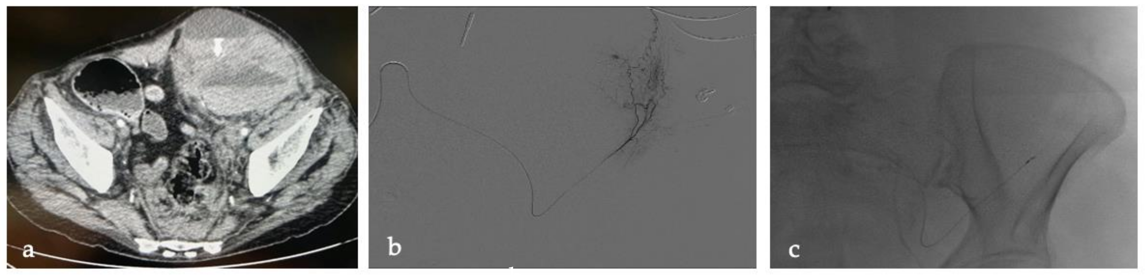 Tomography 09 00089 g002