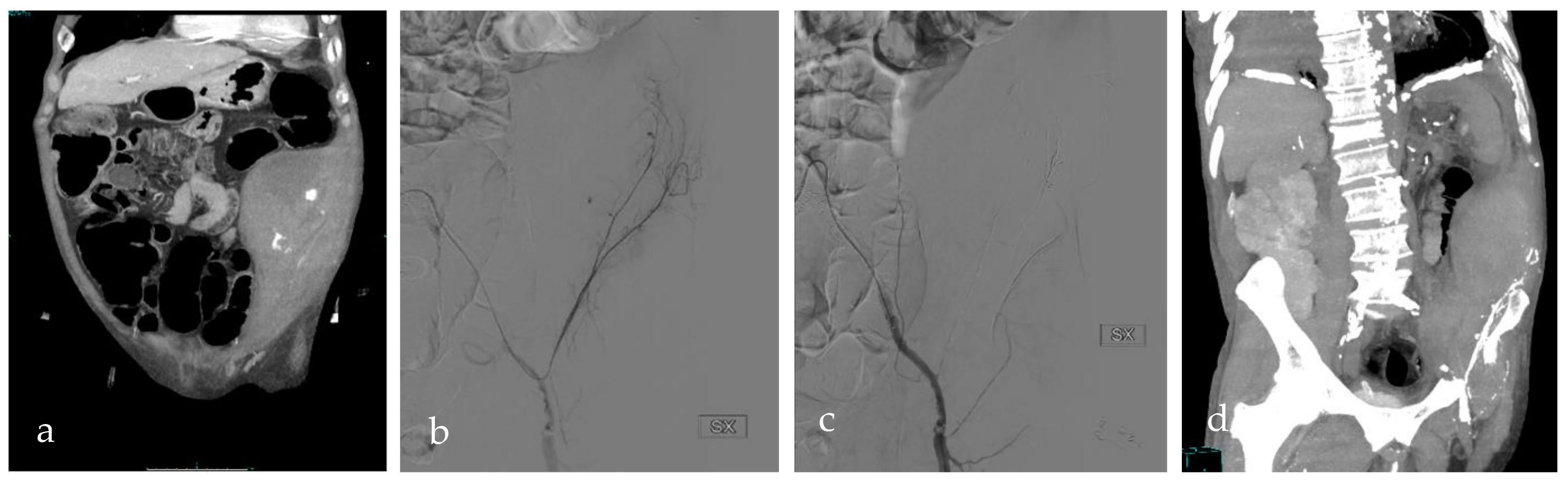 Tomography 09 00089 g003