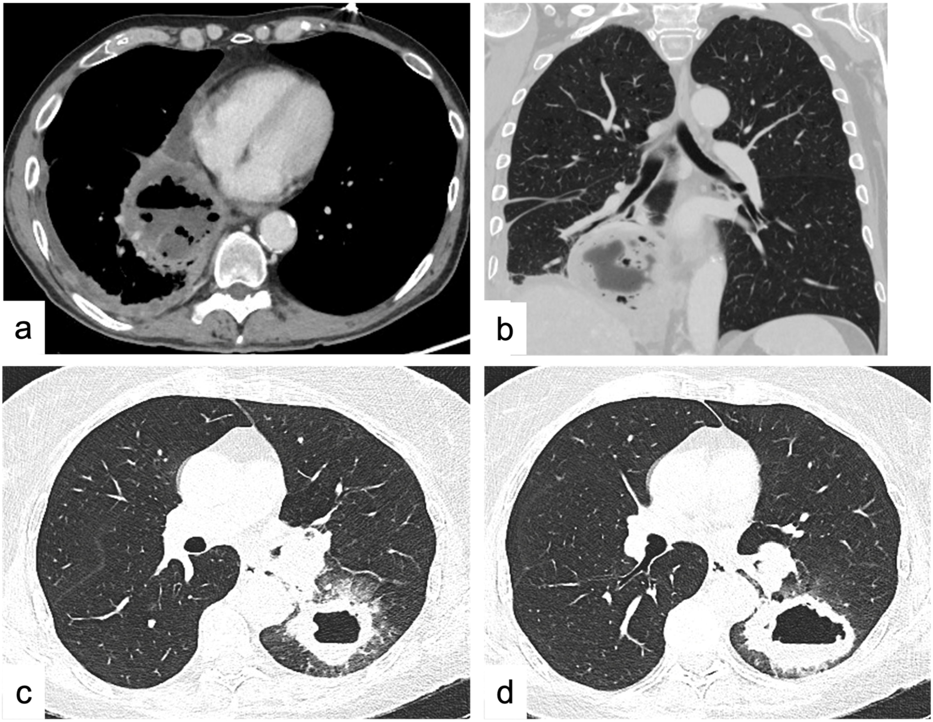 Tomography 09 00095 g001