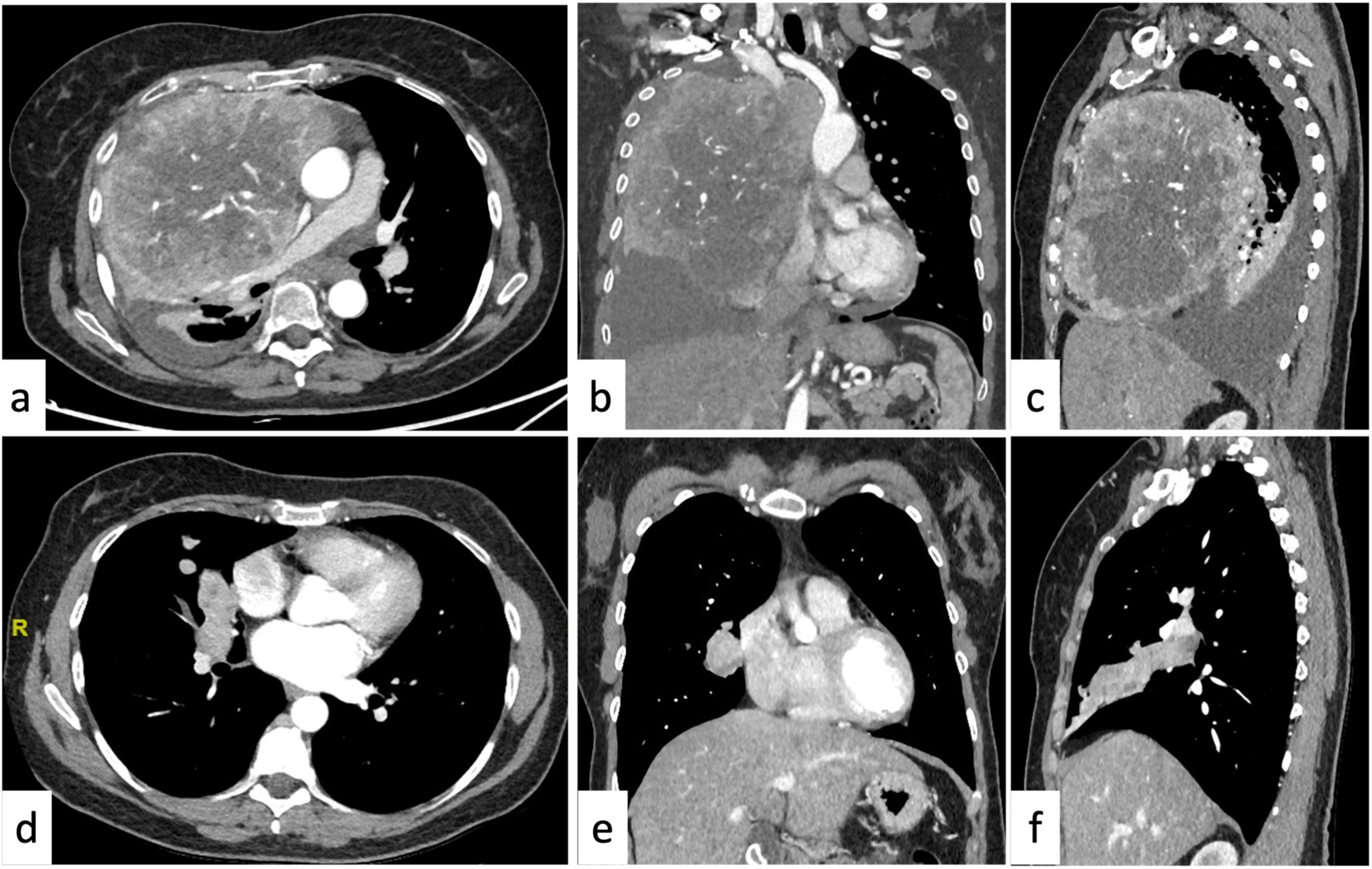 Tomography 09 00095 g002